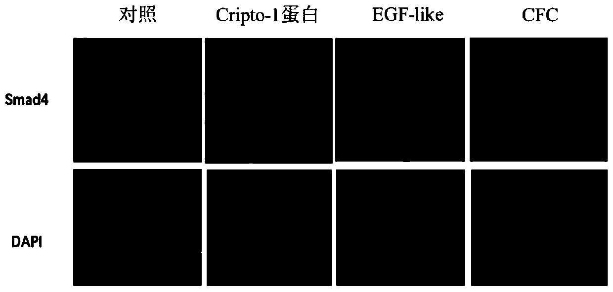 Application of TDGF-1 (teratocarcinoma-derived growth factor-1) truncated micro-molecule polypeptide in anti-hepatic fibrosis