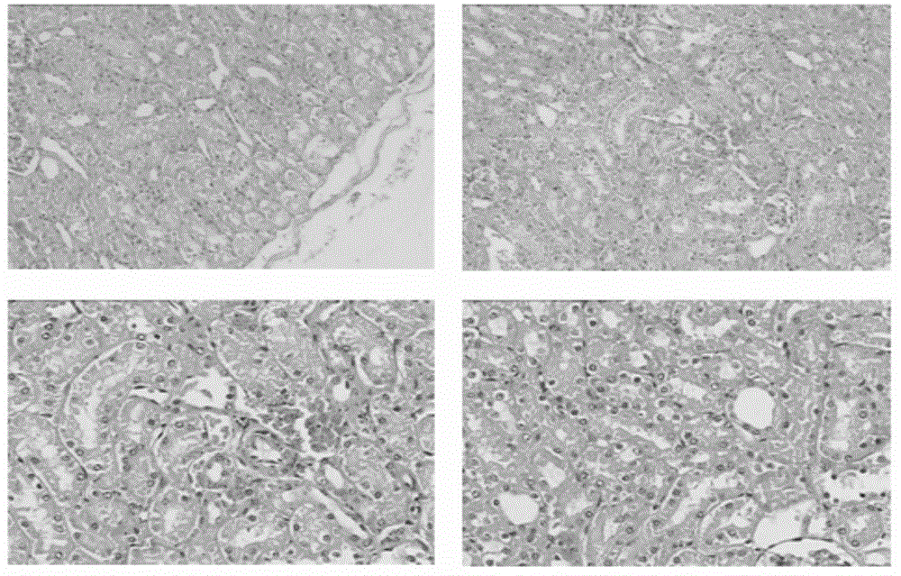 Construction method of tree shrew model with acute hyperuricemia