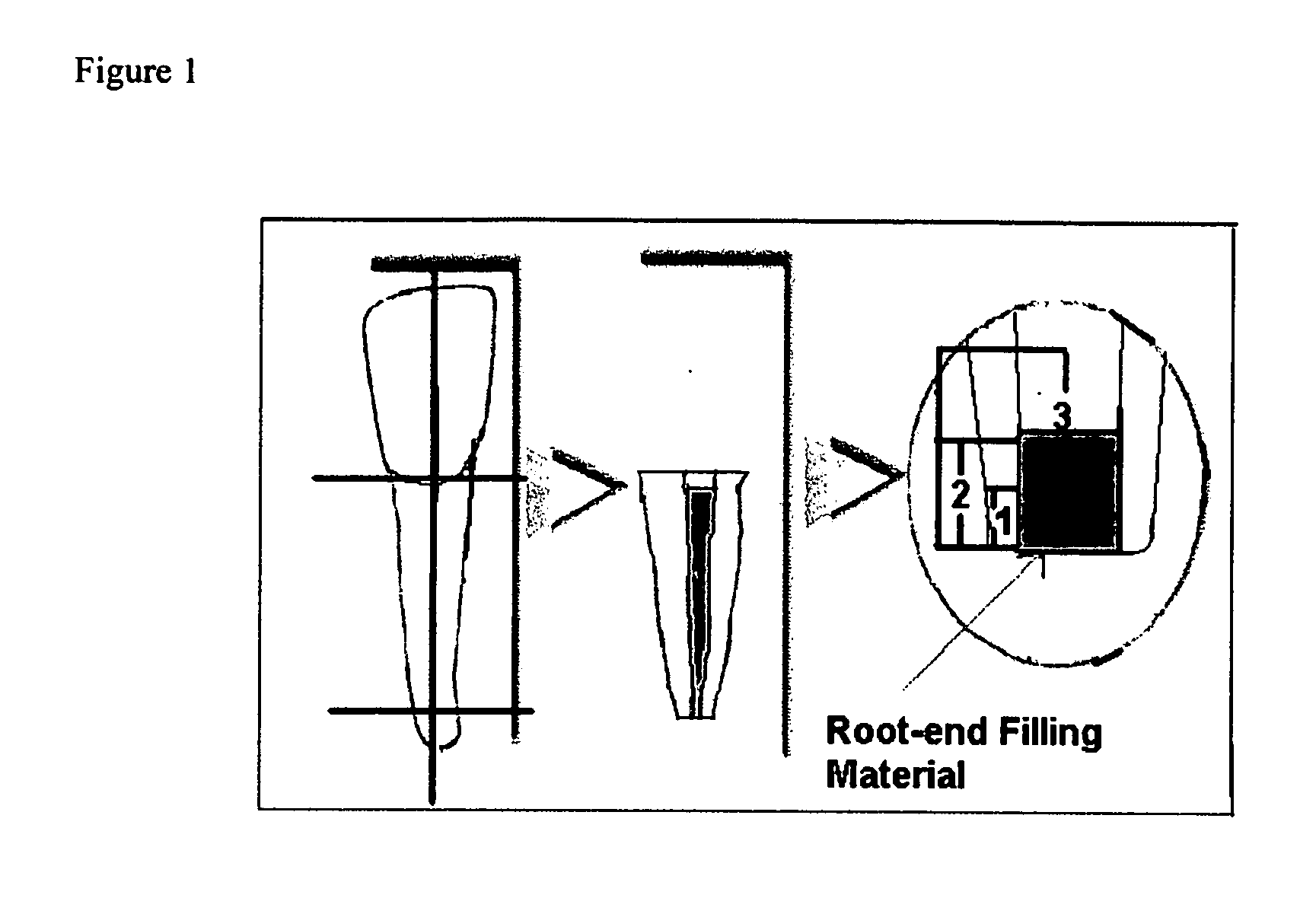 Dental repair material