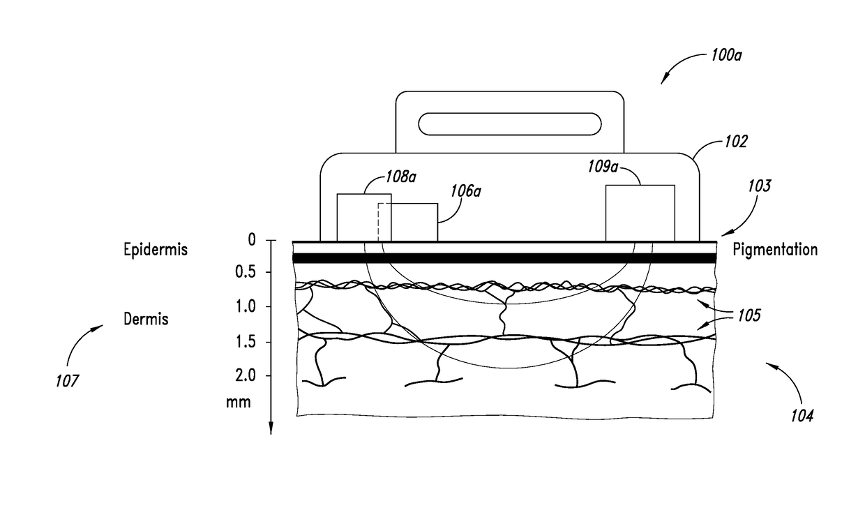 Motion compensation in photopletysmography-based heart rate monitoring