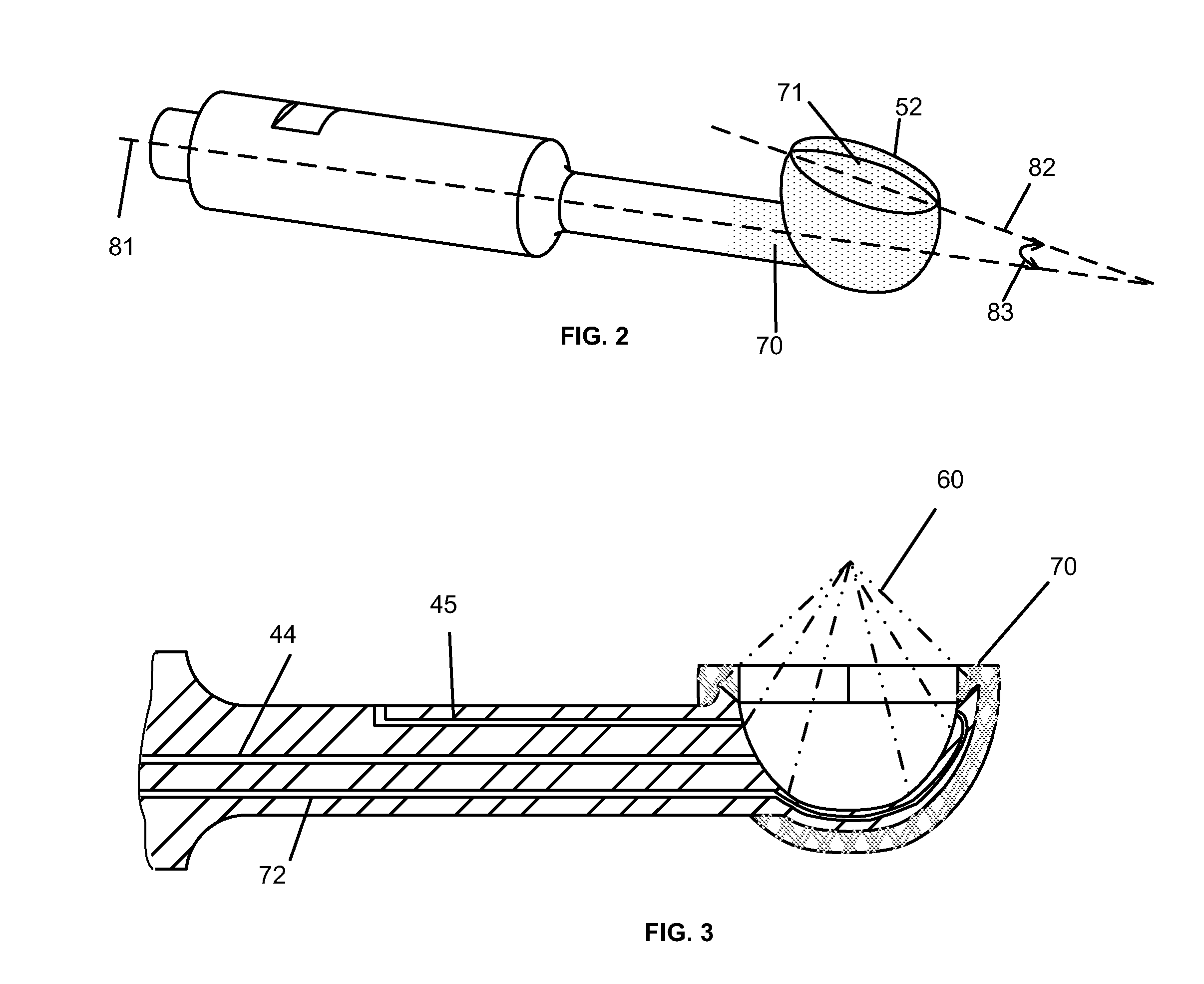 Spider Vein Treatment Apparatus