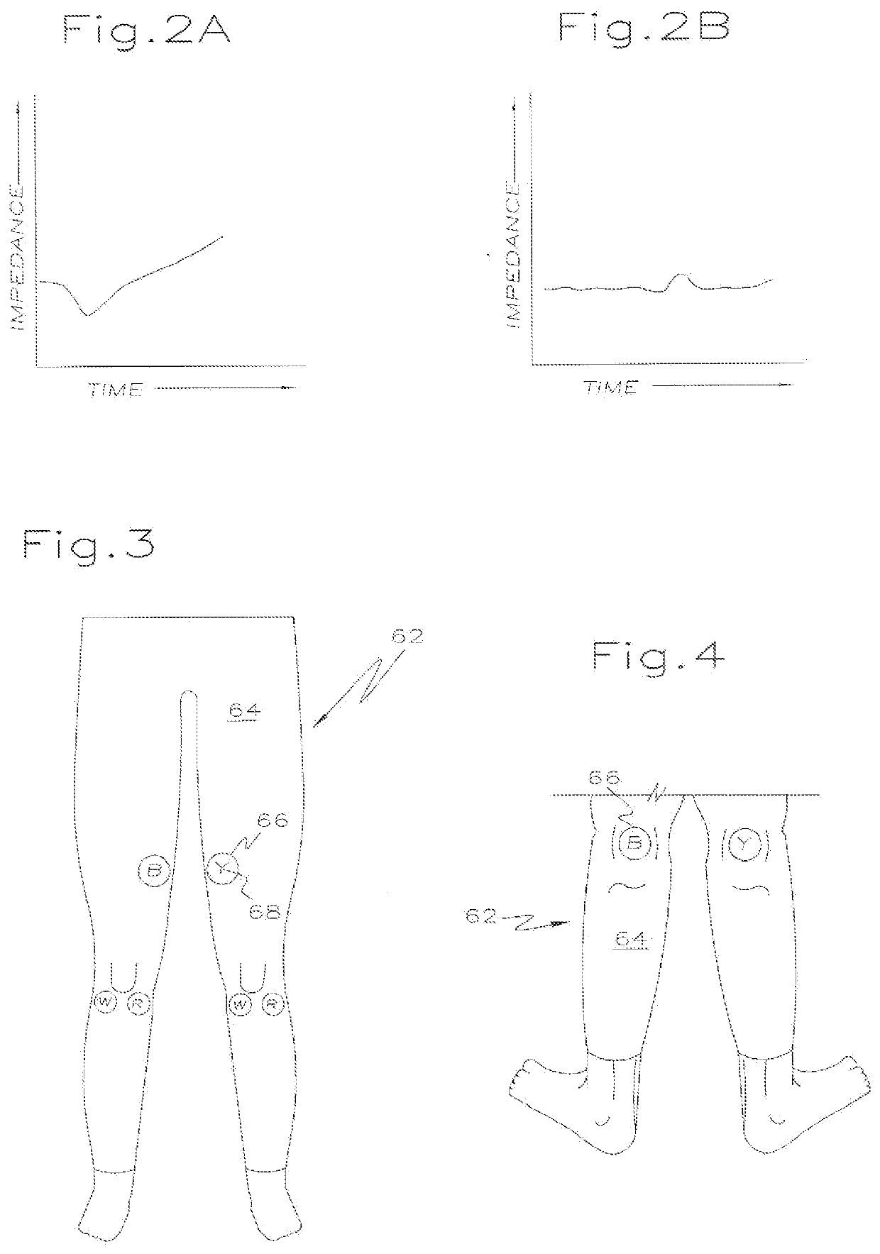 Interferential treatment with modified beat frequency