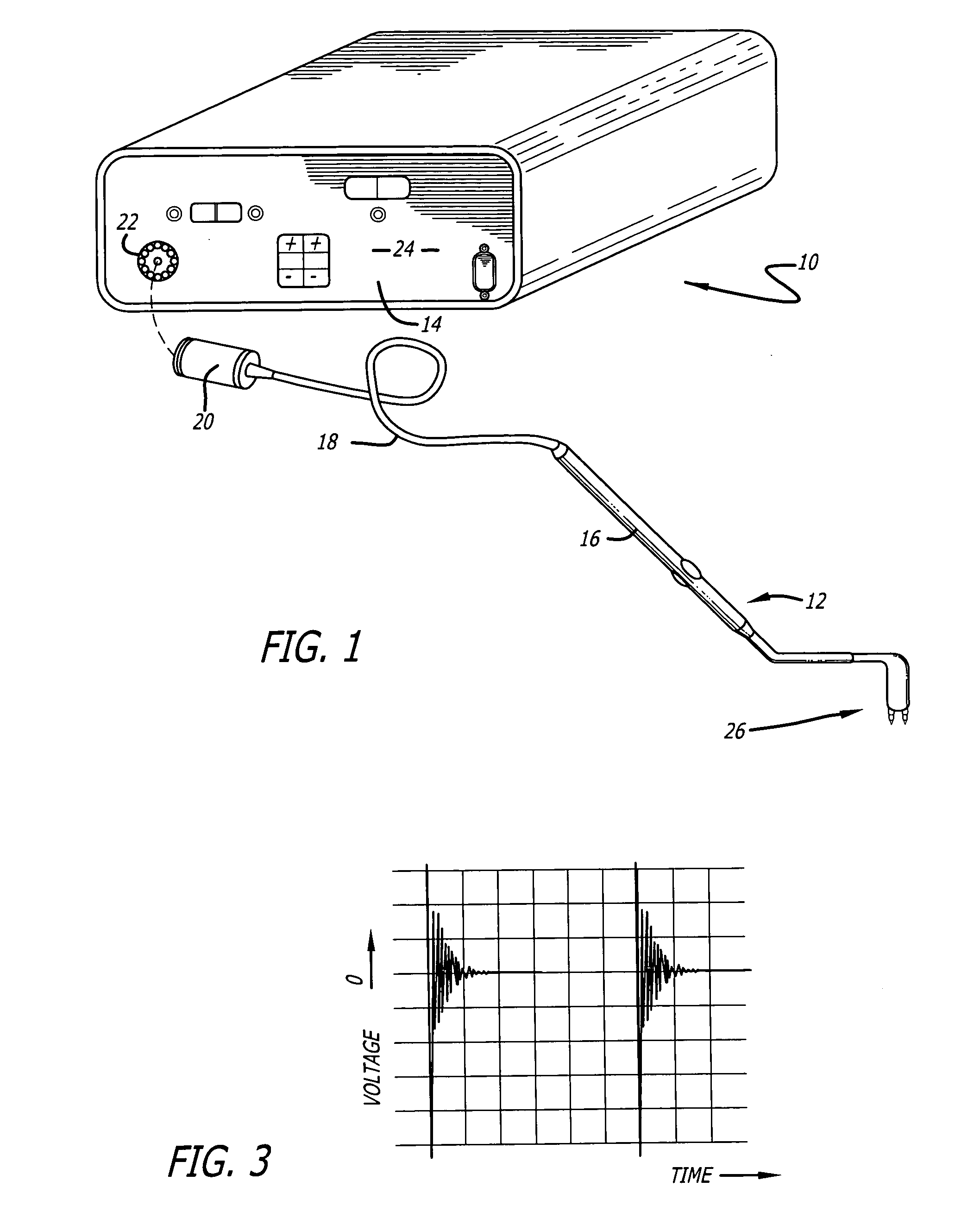 Multi-tip probe used for an ocular procedure