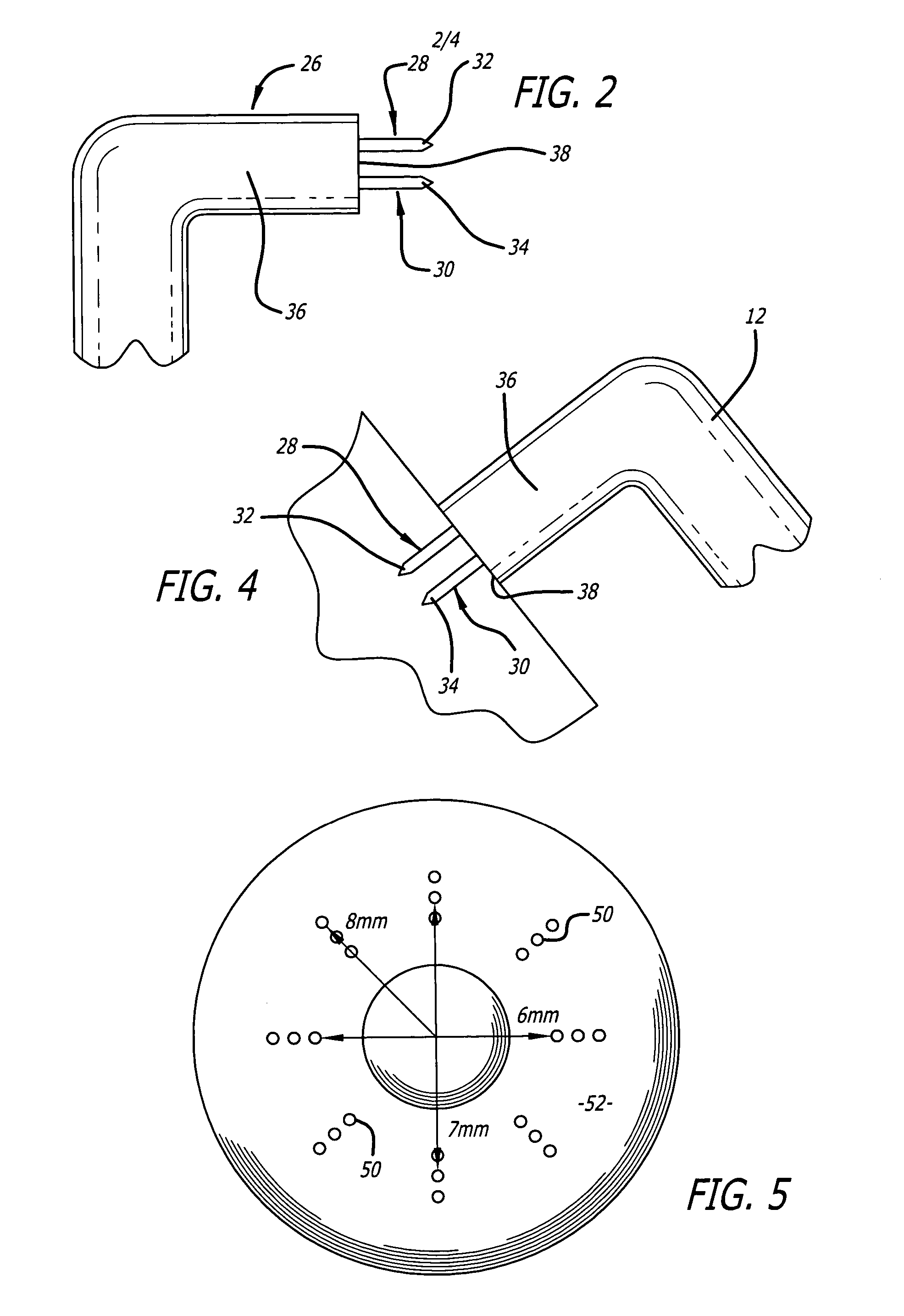 Multi-tip probe used for an ocular procedure