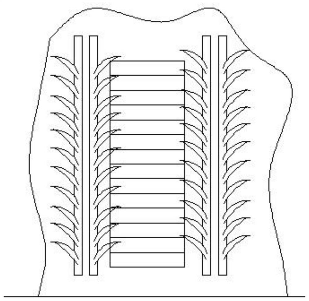 Hillside repairing device