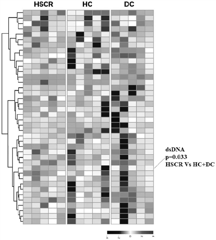 Application of anti-double-stranded DNA antibody as congenital megacolon diagnostic marker