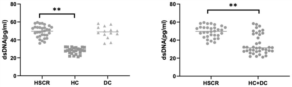 Application of anti-double-stranded DNA antibody as congenital megacolon diagnostic marker