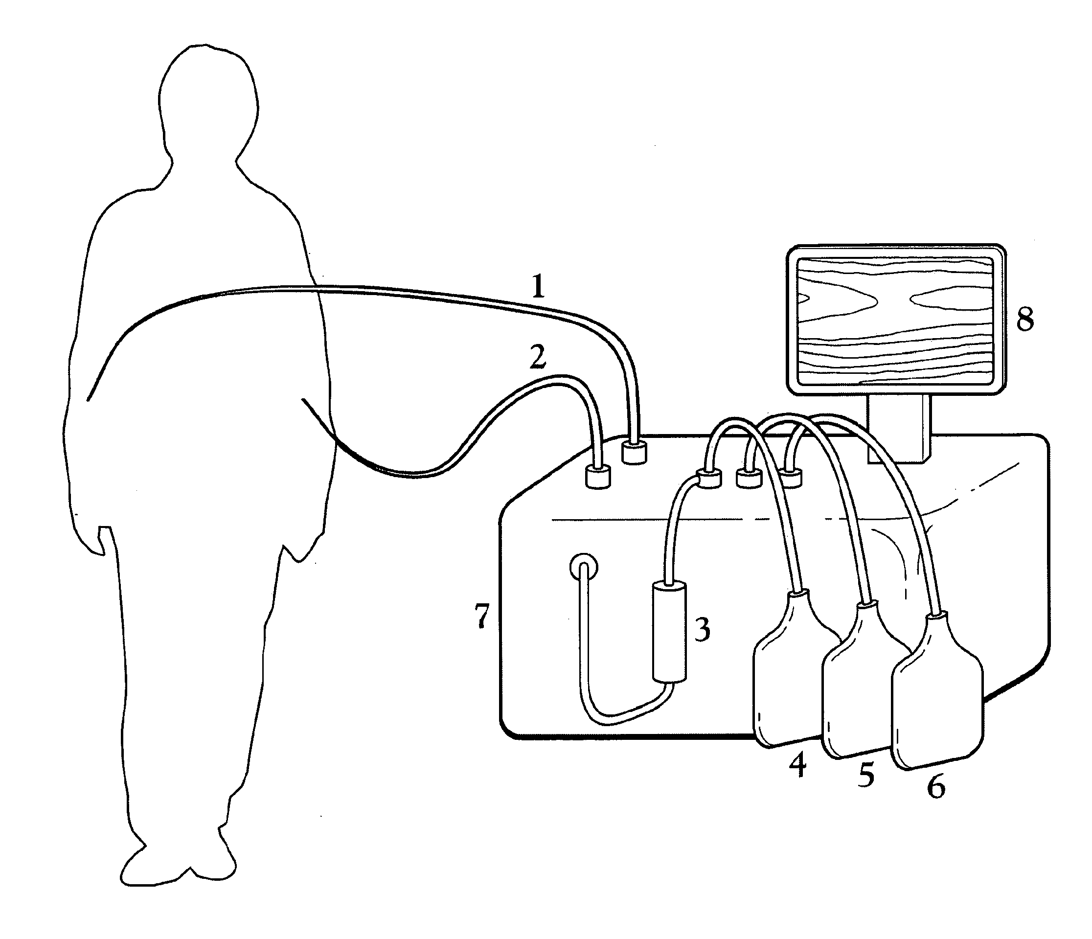 A Blood Purification Method and Apparatus for the Treatment of Malaria