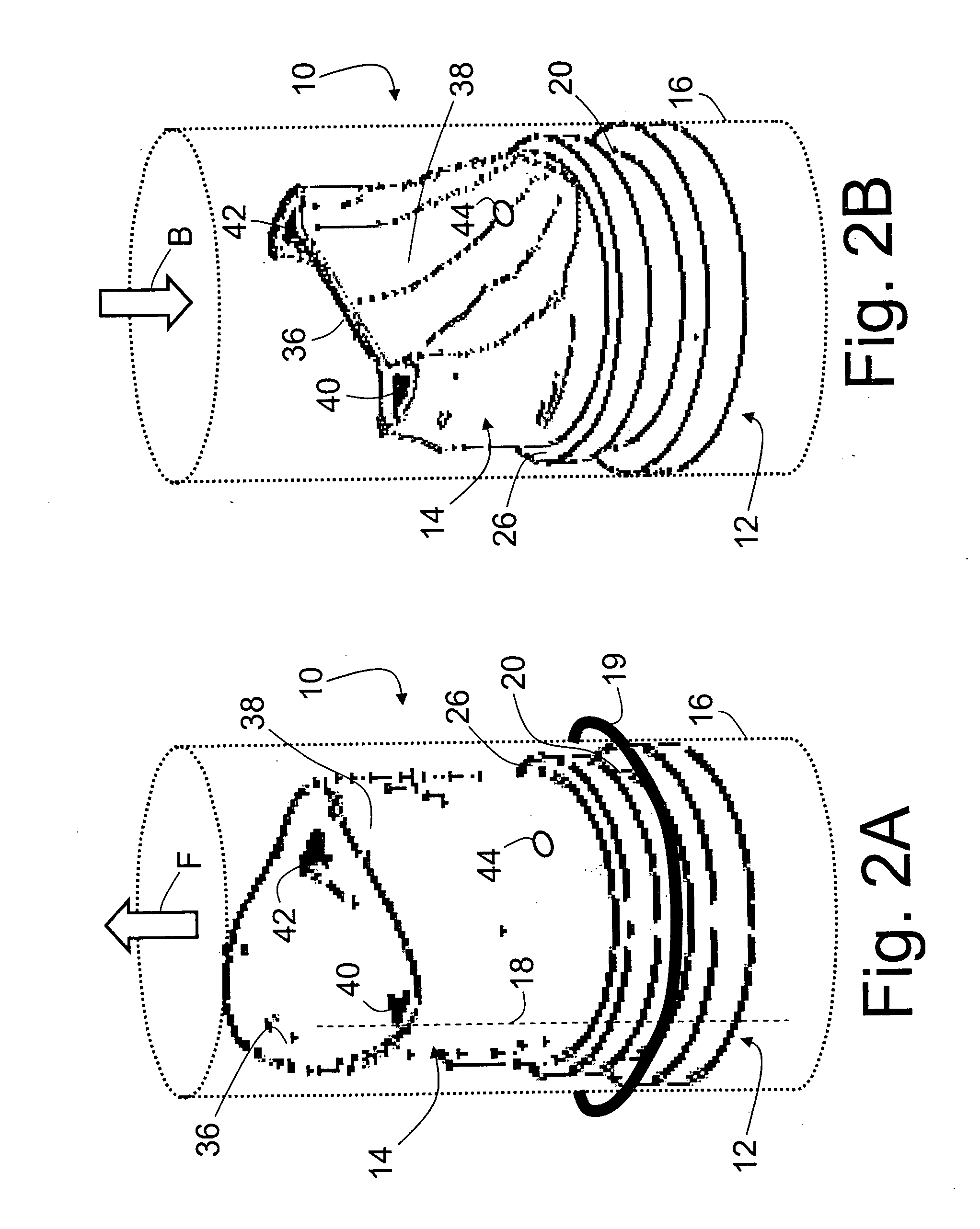 Prosthetic venous valves