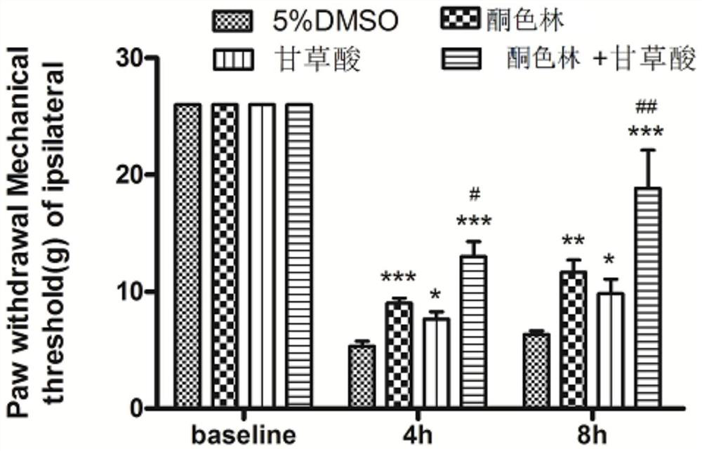 Application of ketanserin and glycyrrhizic acid in preparation of medicine for treating pain