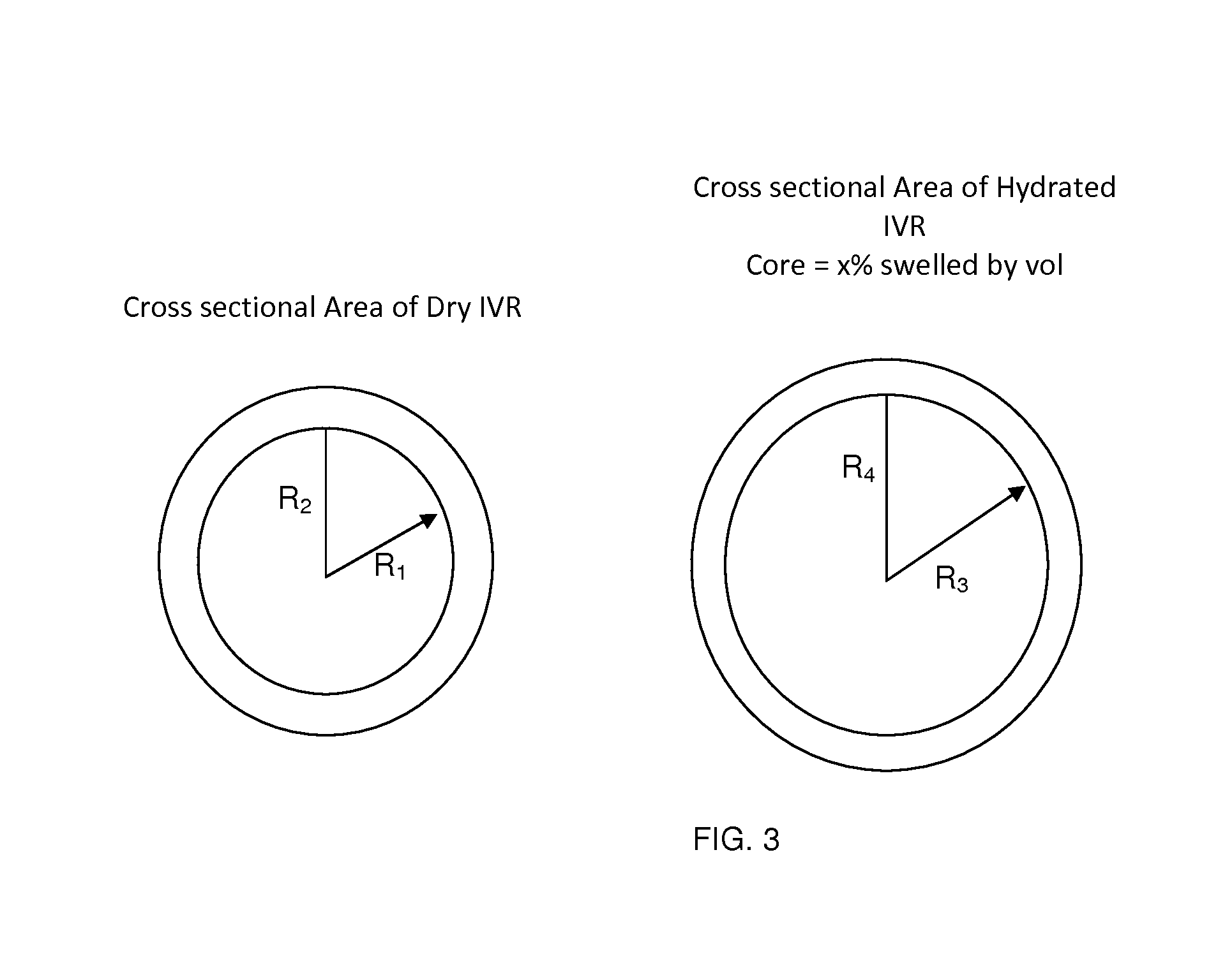 Core sheath drug delivery devices