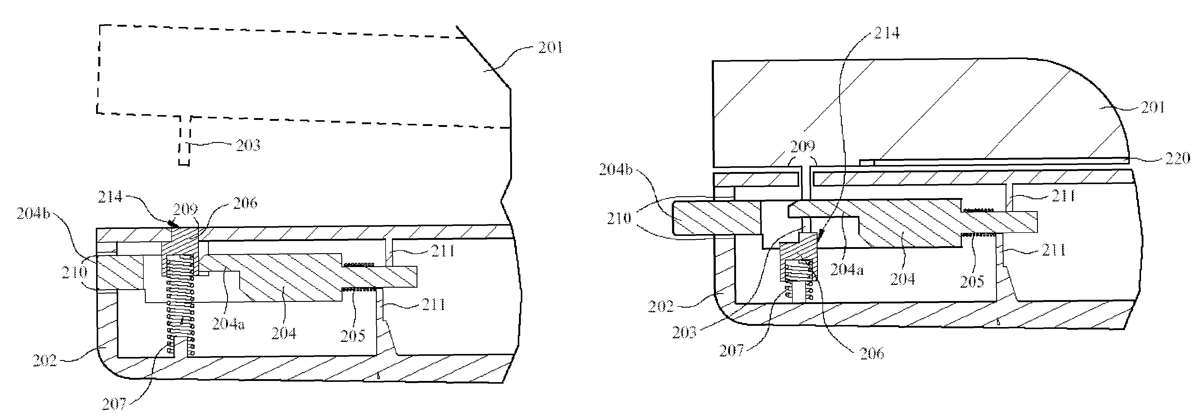 Case structure of portable electronic device