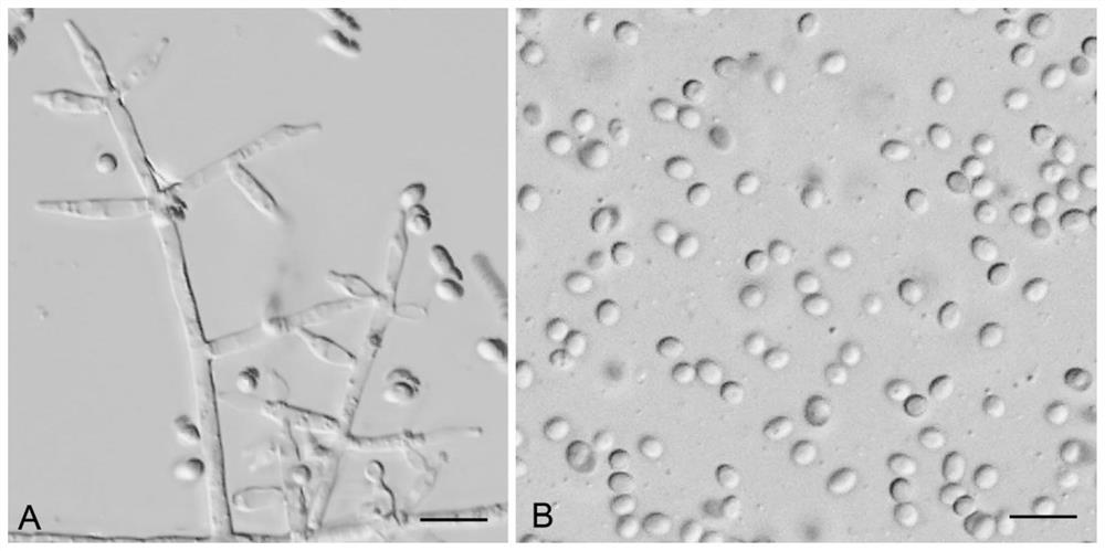 Trichoderma harzianum SQ-18 strain and application thereof to prevention and treatment of turfgrass diseases