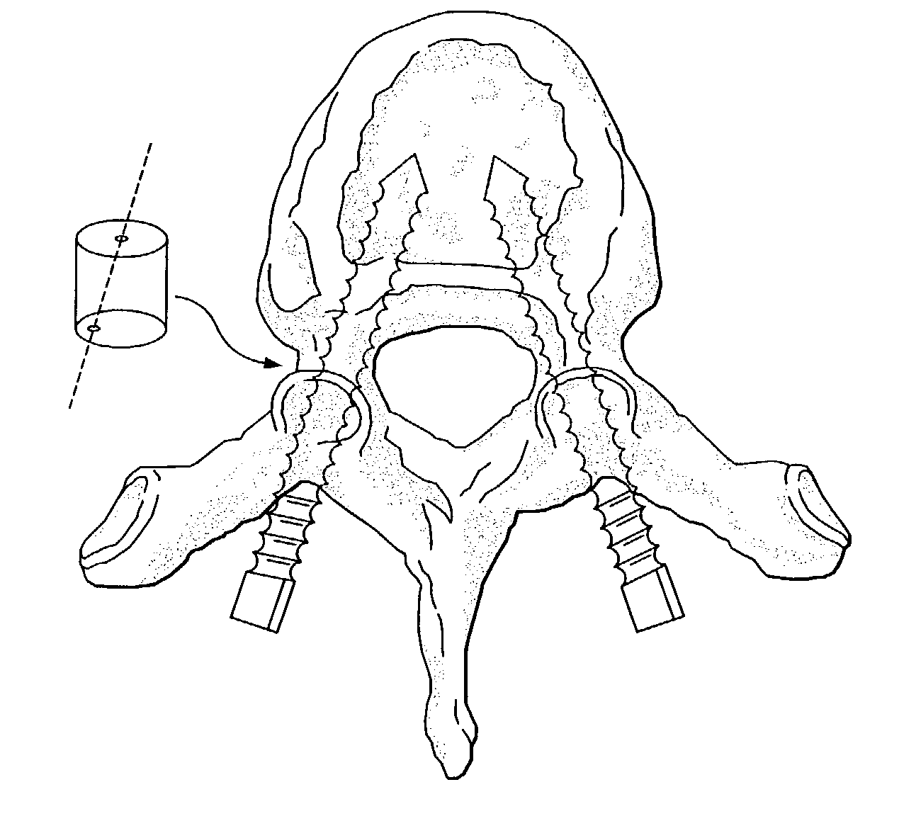 Methods and systems for image-guided placement of implants