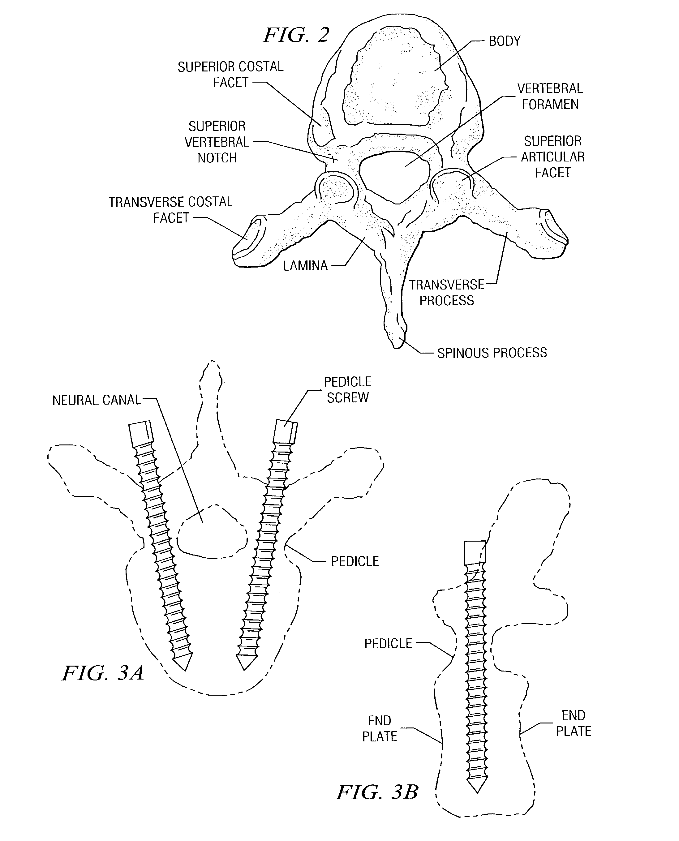 Methods and systems for image-guided placement of implants