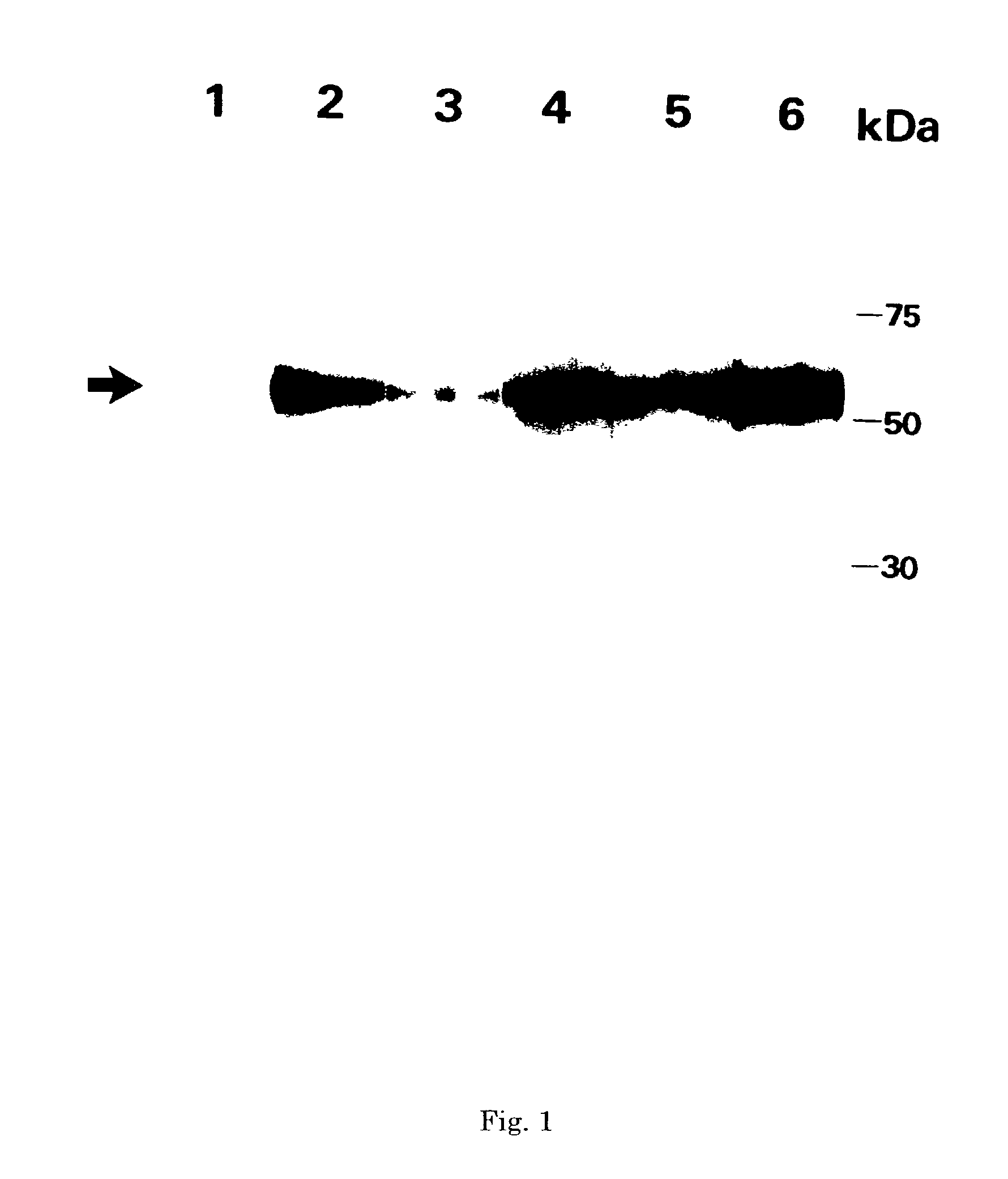 Monoclonal antibody and method and kit for immunoassay of soluble human ST2