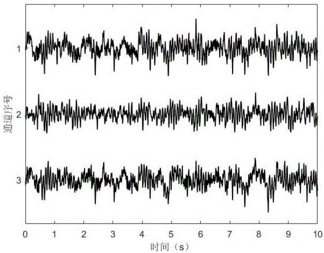 Elimination method for myoelectricity artifacts in small-number-channel brain electrical signals