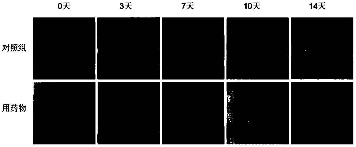 A kind of pharmaceutical composition and application thereof for promoting skin healing