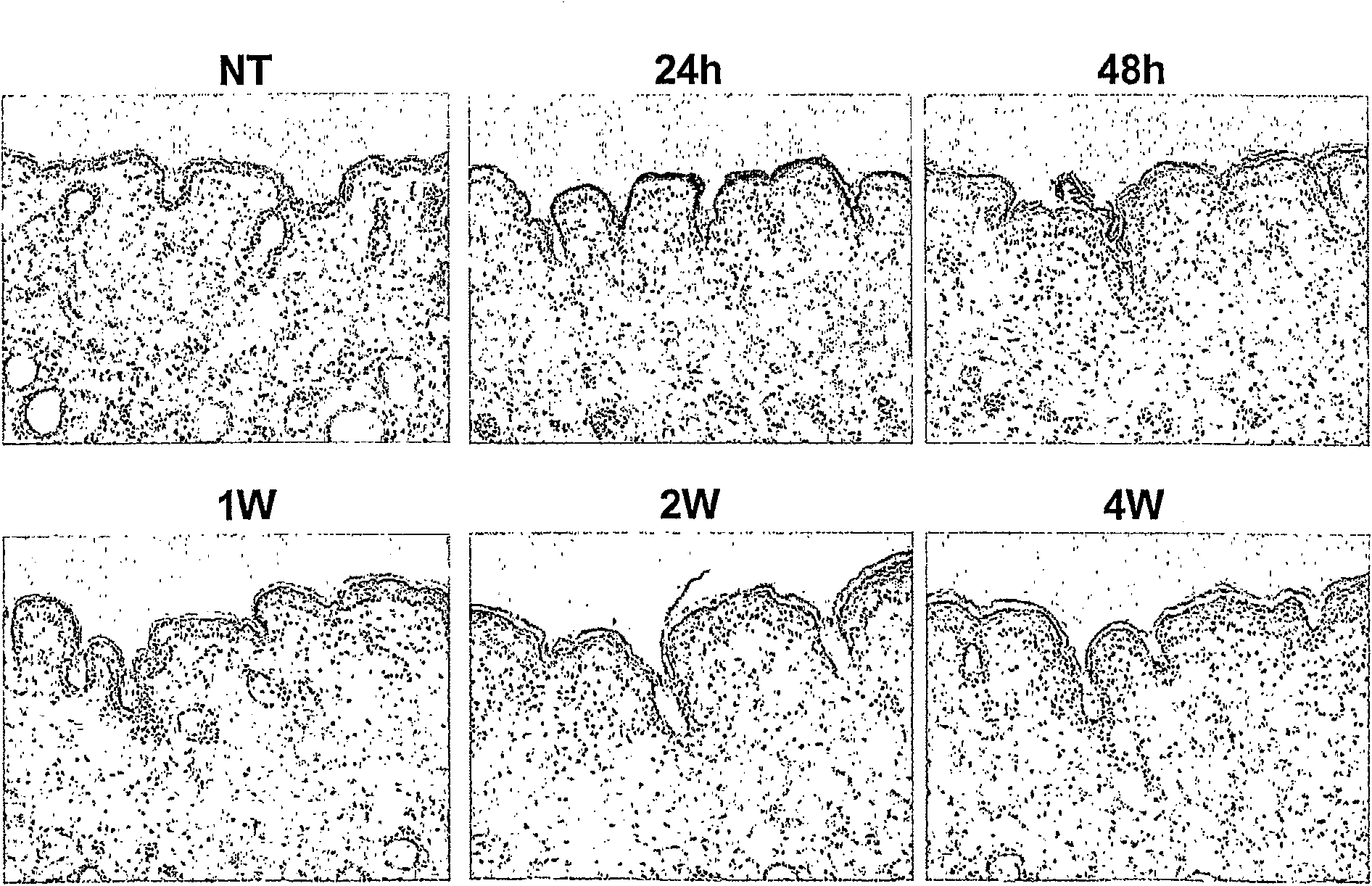 Prevention or improvement of wrinkles by using adam activation inhibitor