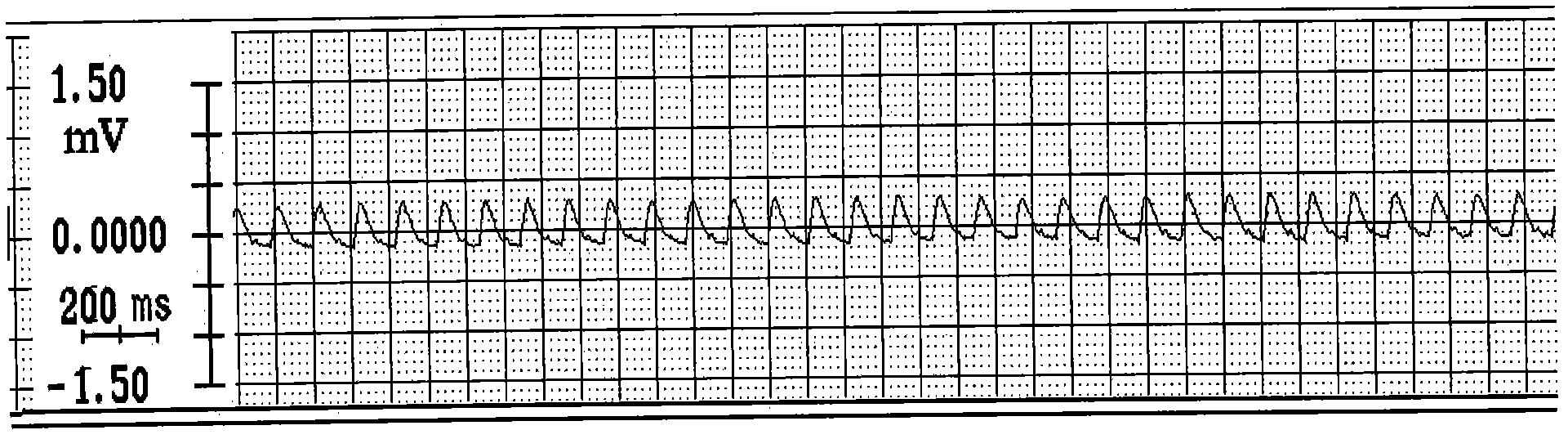 Preparation method of myocardial ischemia/reperfusion model in rats