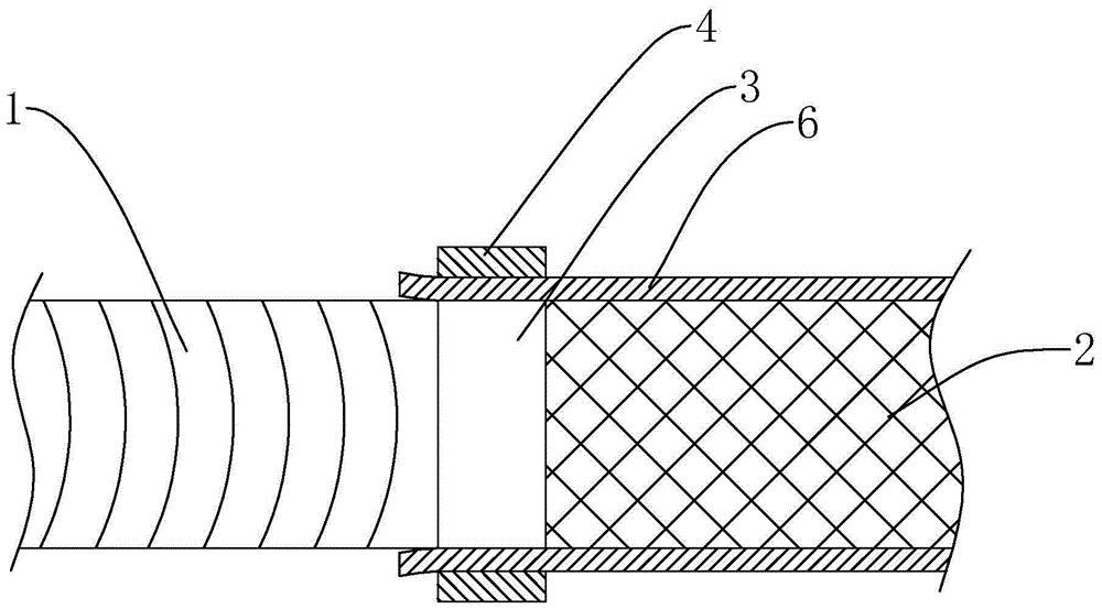 Artificial blood vessel and covered stent connection mechanism for aortic operation