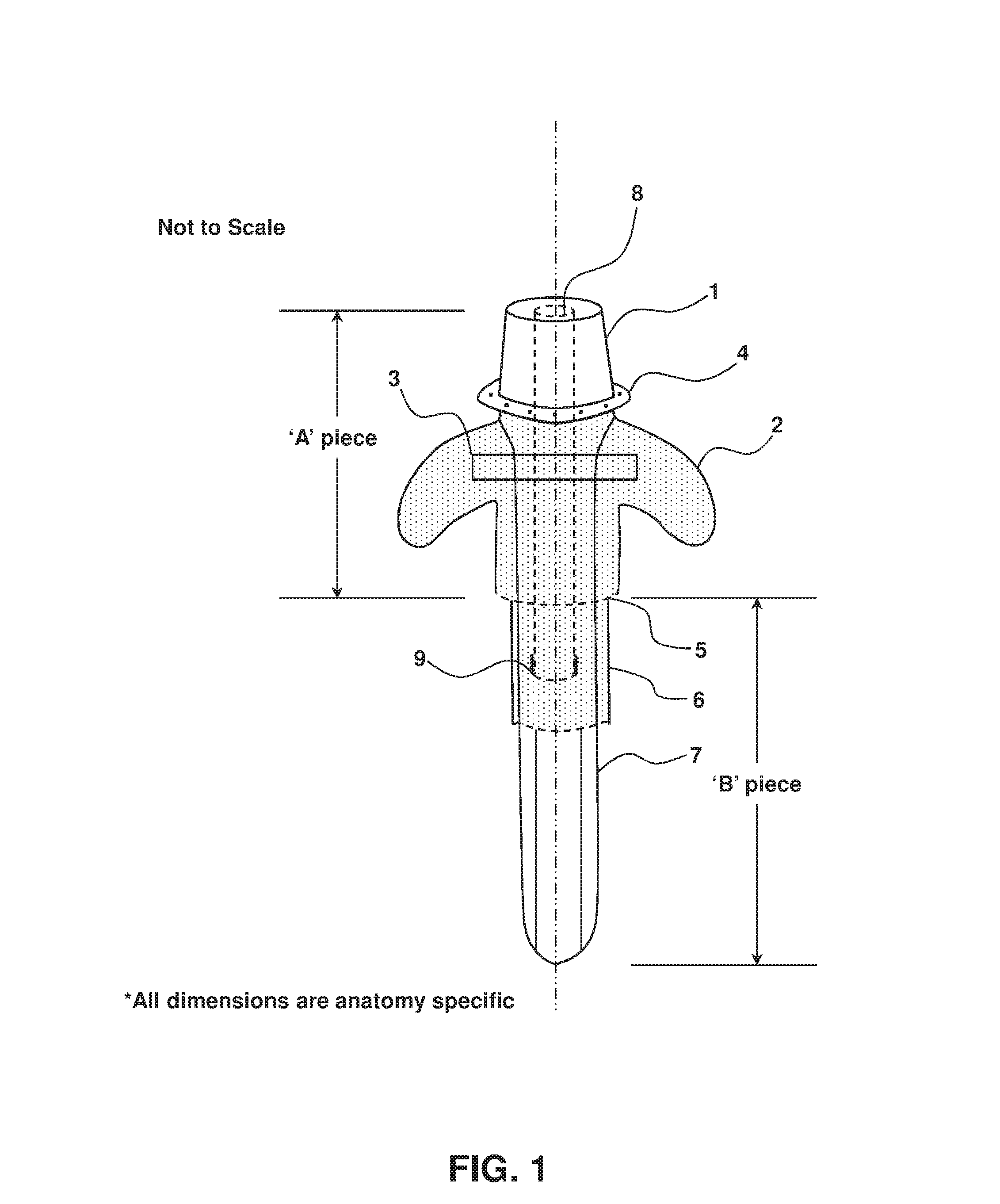 Transcutaneous implant for skeletal attachment of external prosthetic devices