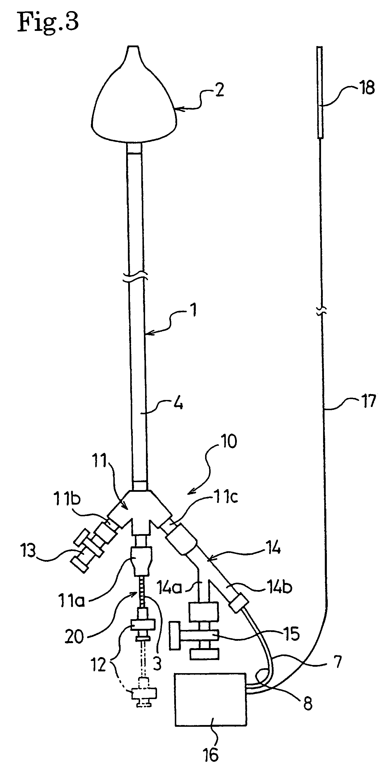 Catheter for treating of arrhythmia