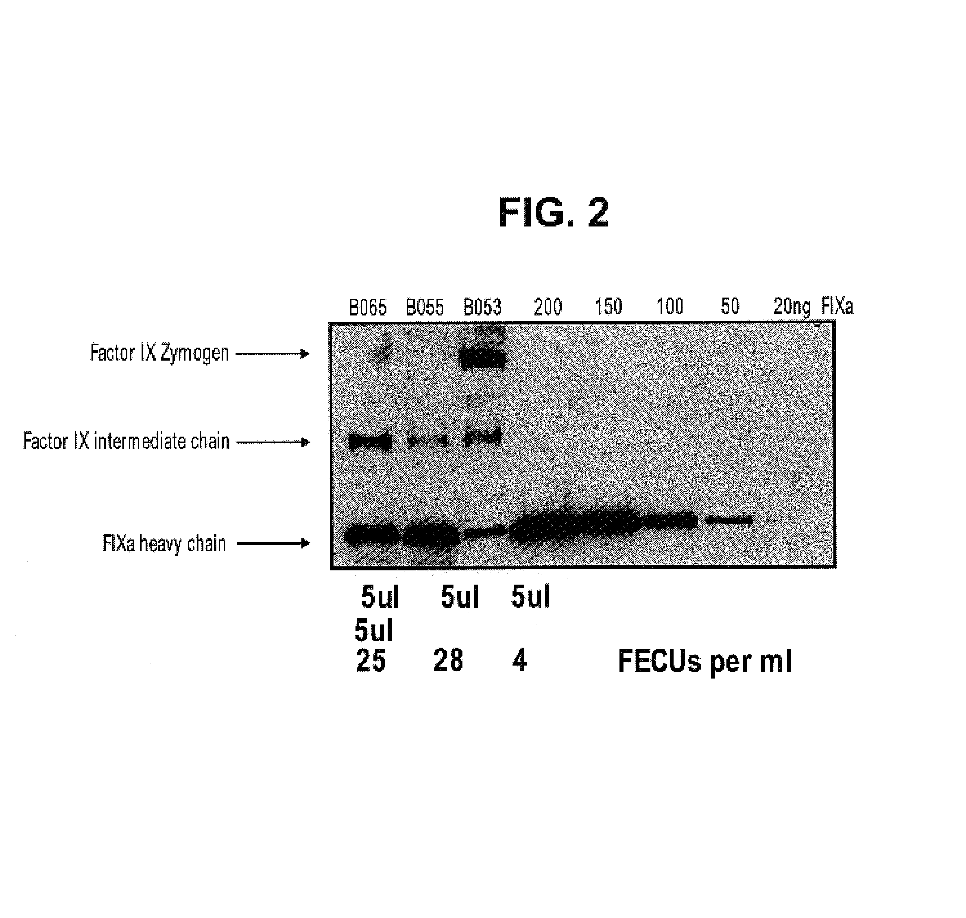 Factor IXa for the treatment of bleeding disorders