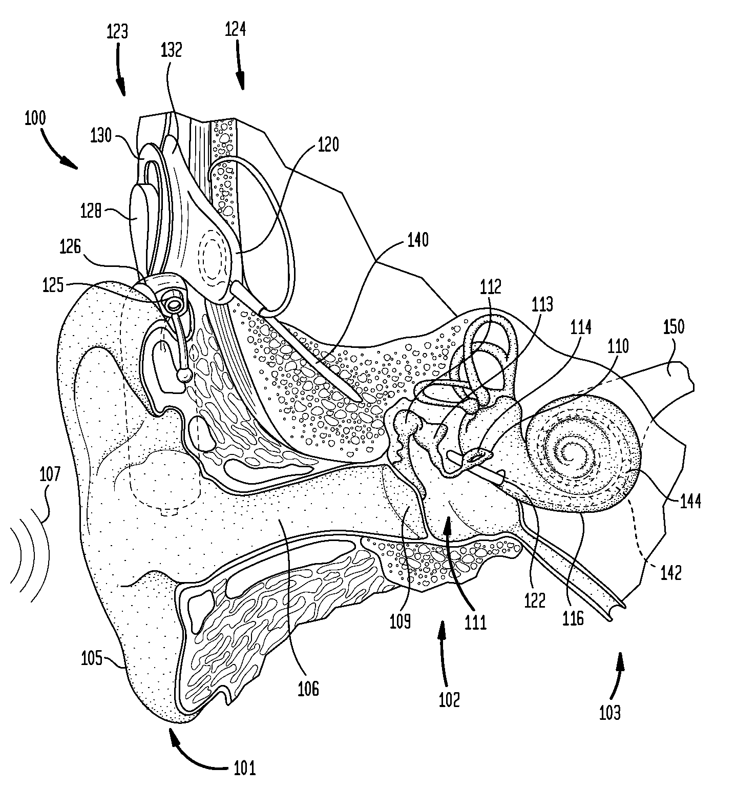 Perception-based parametric fitting of a prosthetic hearing device