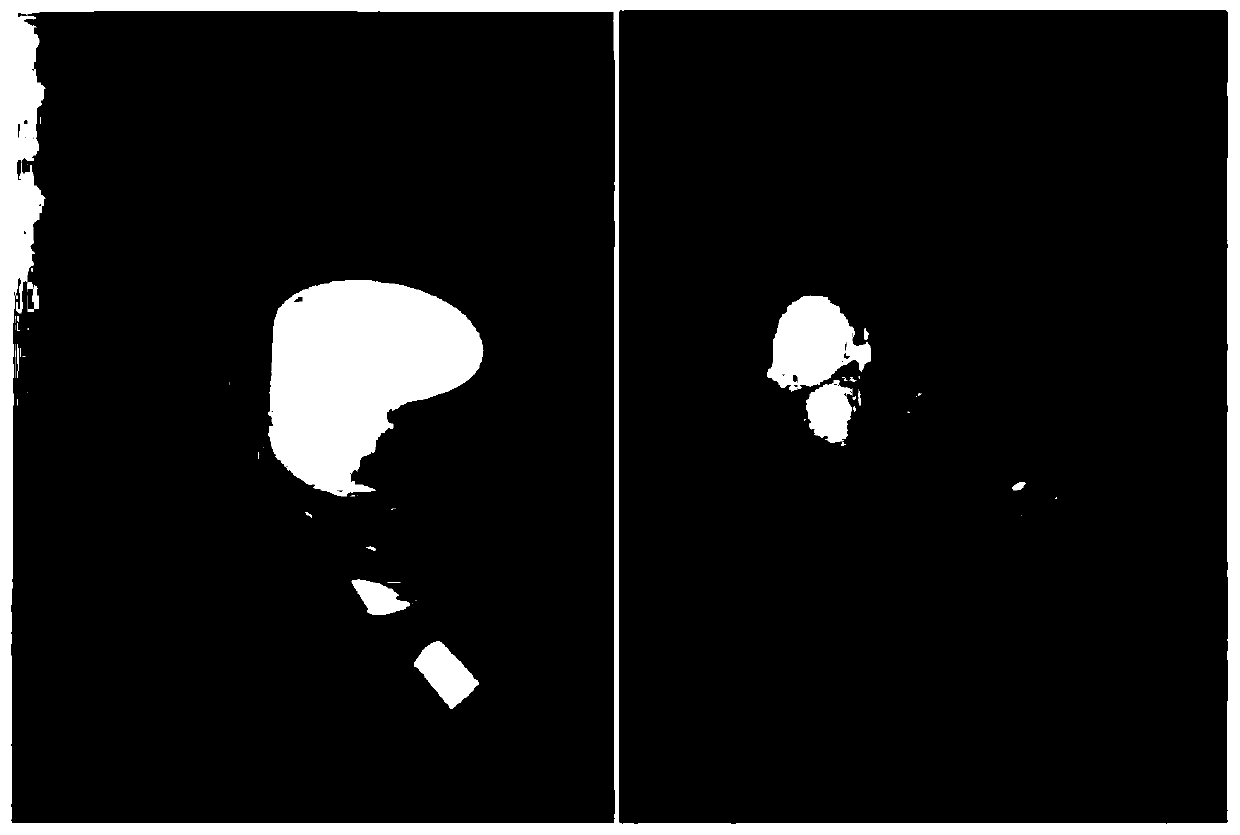 Anti-blue-light cosmetic composition and preparation method thereof