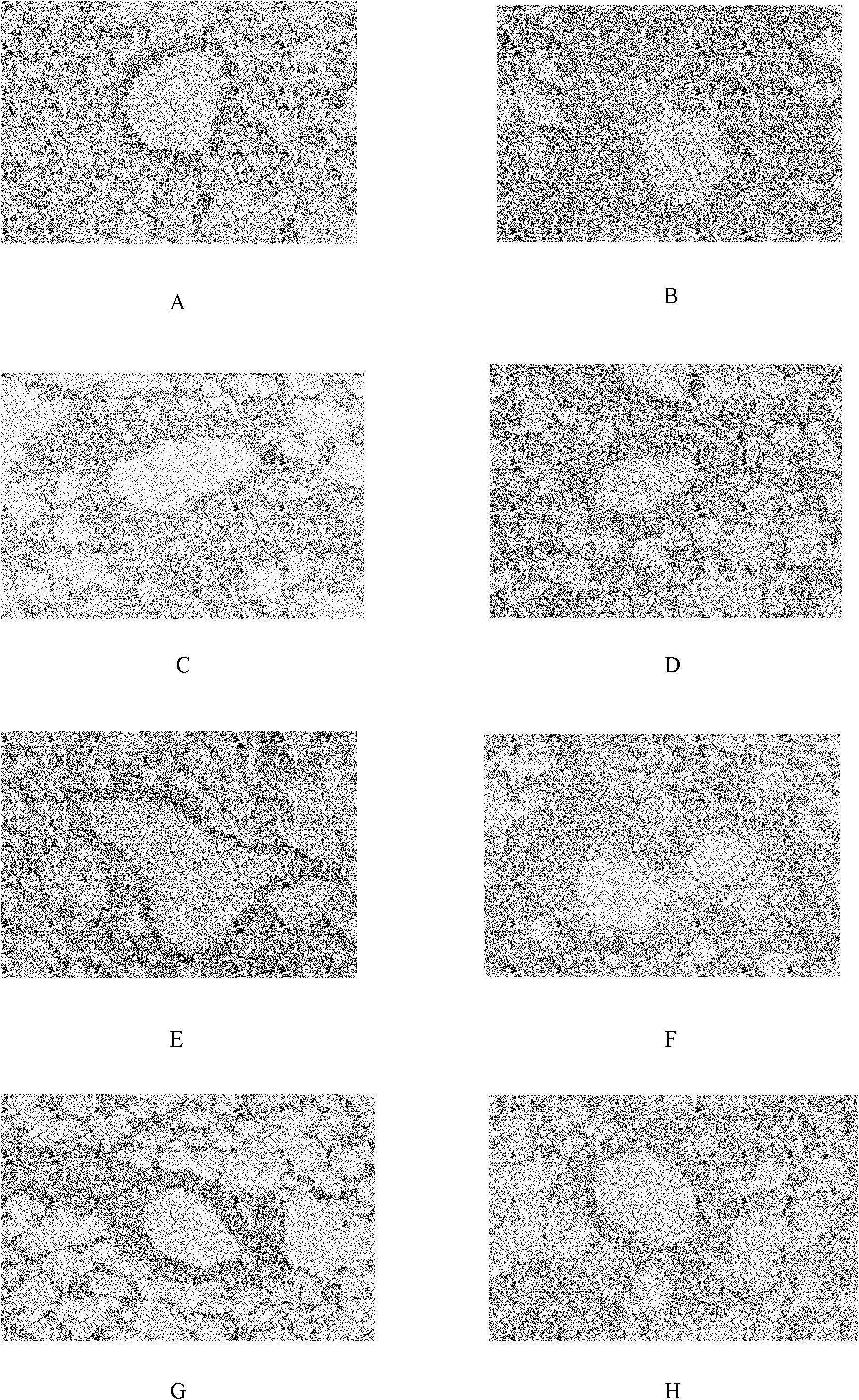 Medicinal composition for preventing and treating bronchial asthma and preparation and application thereof