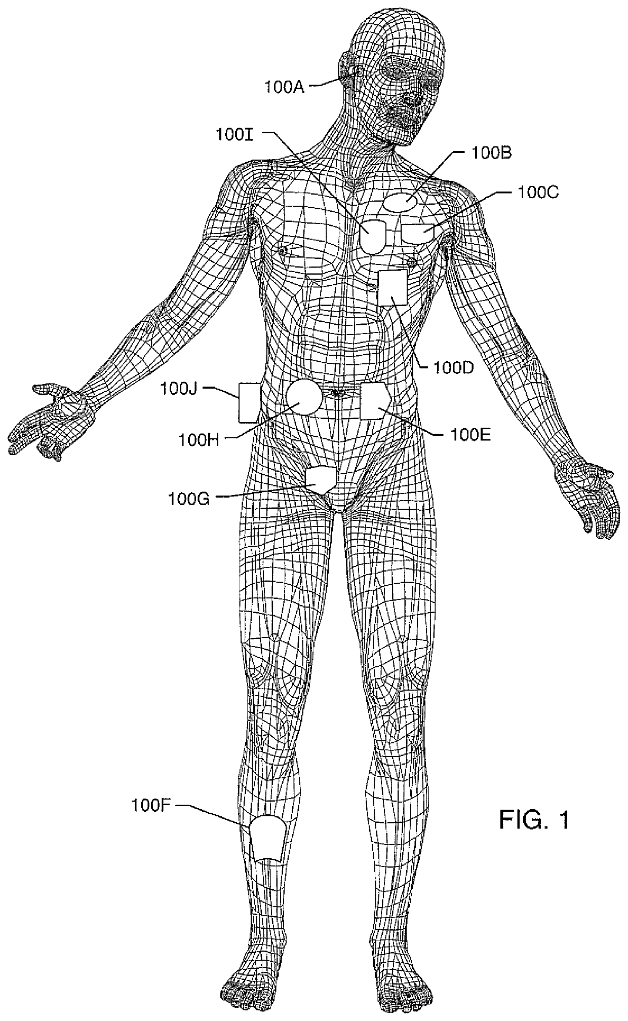 Triple Flip, Clinical Magnet Multiple Polarity And Placement Timed Sensing To Prevent Inadvertent Actuation Of Magnet-Mode In An Active Implantable Medical Device