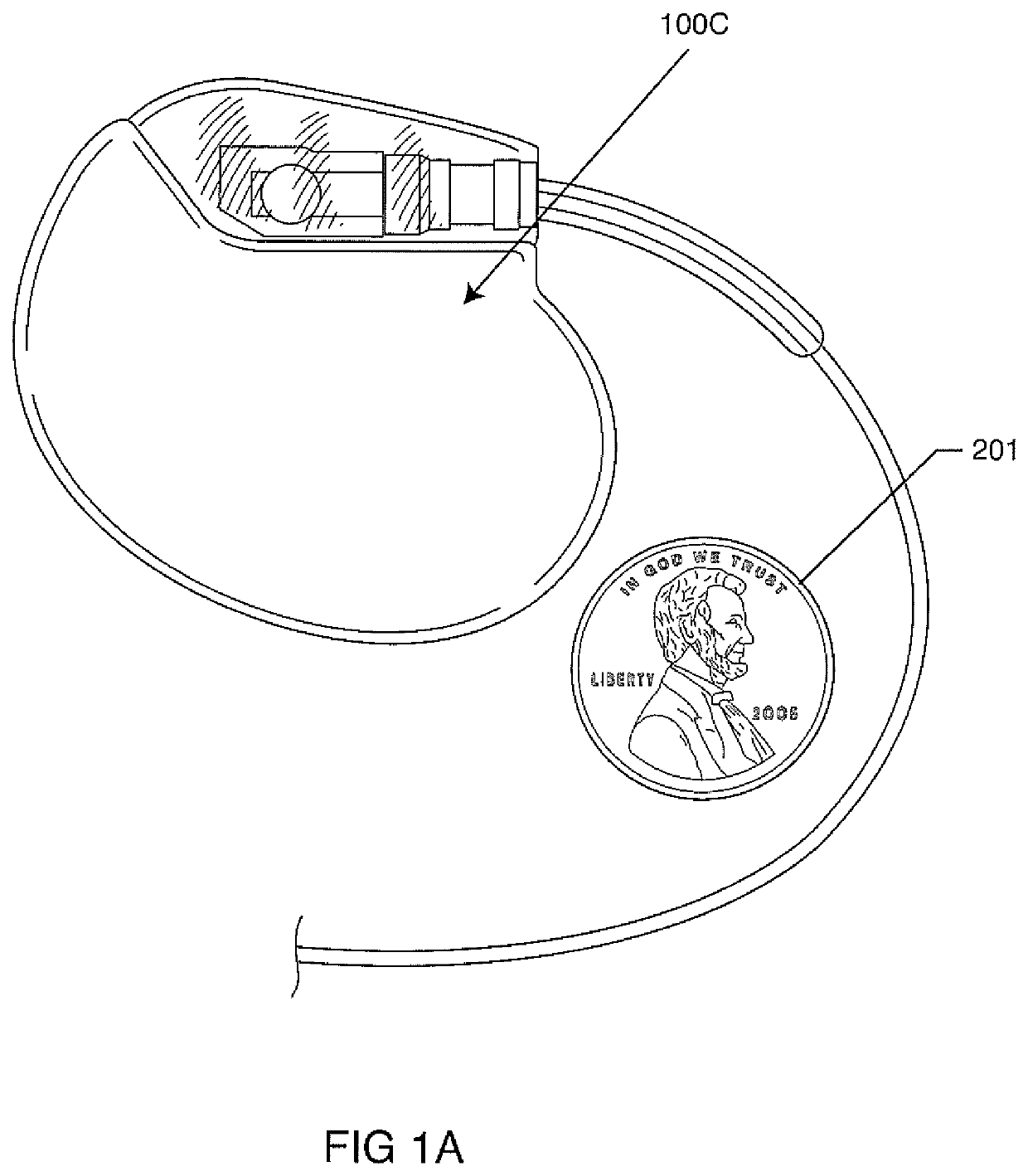 Triple Flip, Clinical Magnet Multiple Polarity And Placement Timed Sensing To Prevent Inadvertent Actuation Of Magnet-Mode In An Active Implantable Medical Device