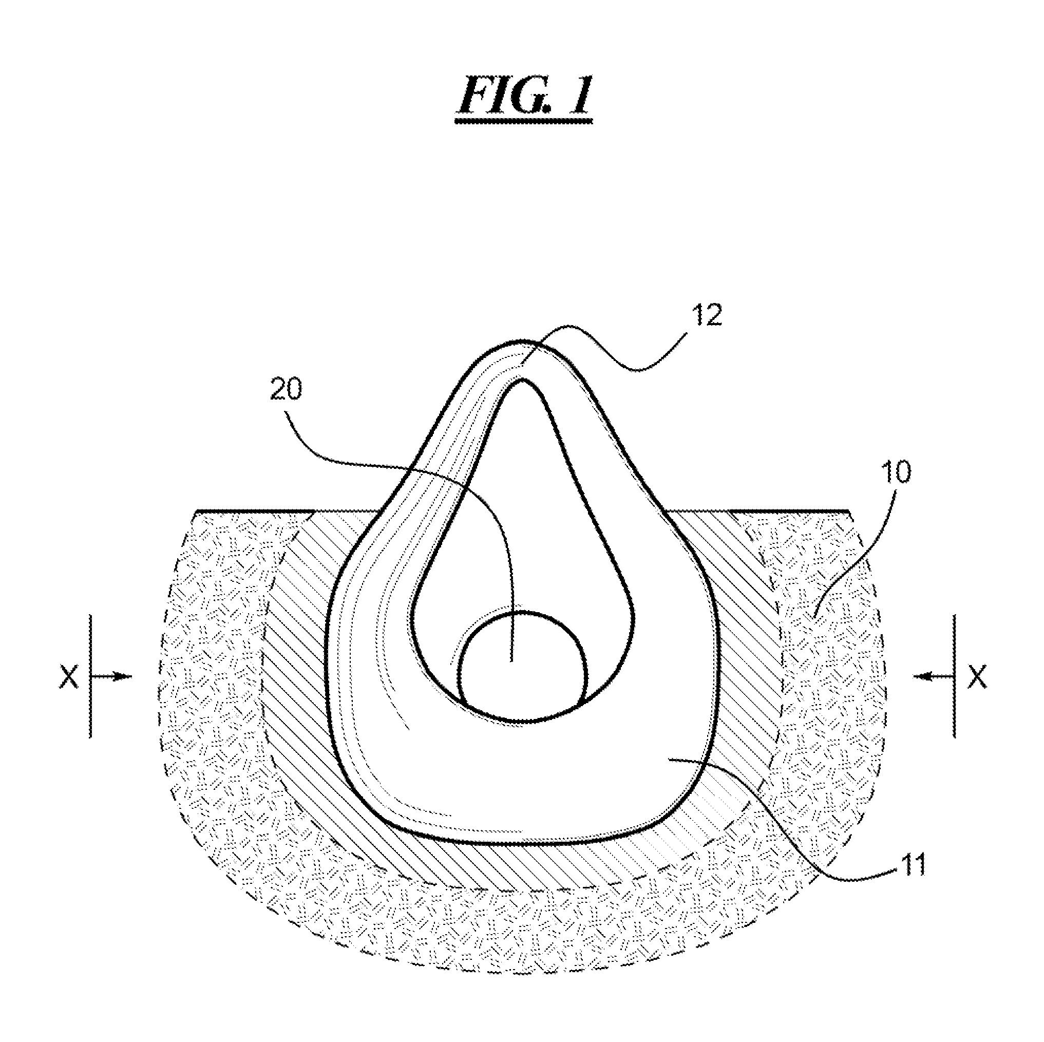 Low profile filter respirator