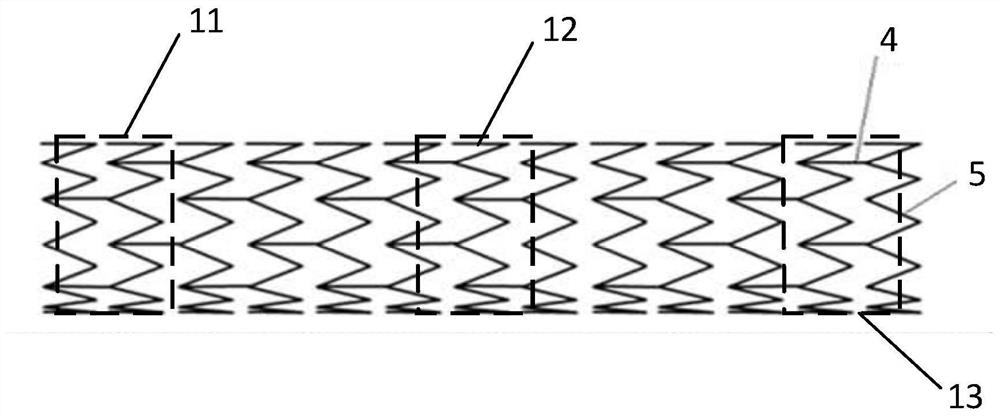 Restenosis monitoring device and method based on intelligent coronary artery stent