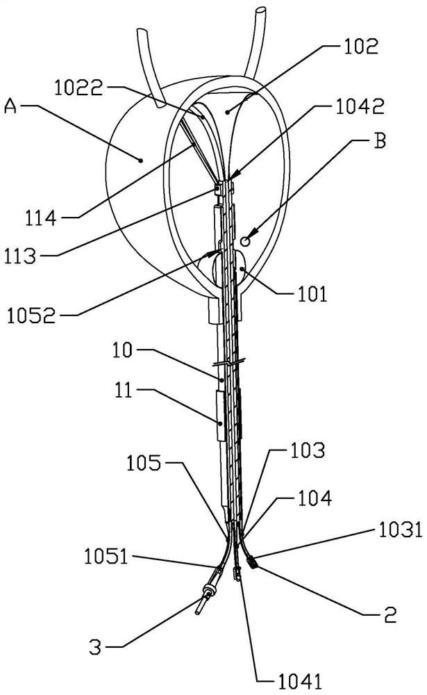 An oncology bladder drug delivery device