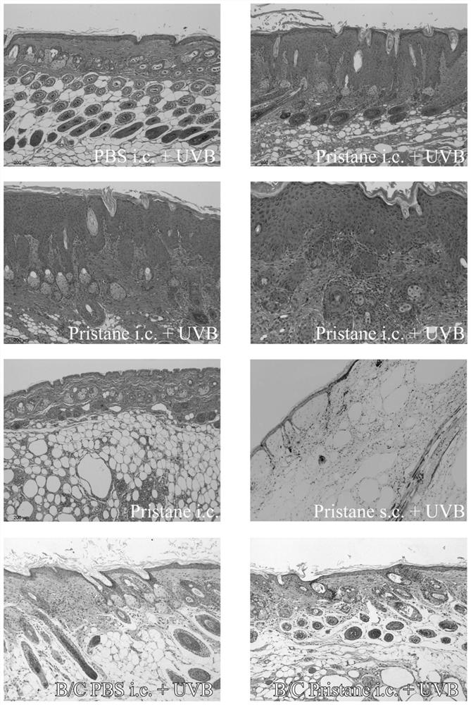 Skin type lupus erythematosus mouse model and construction method and application thereof