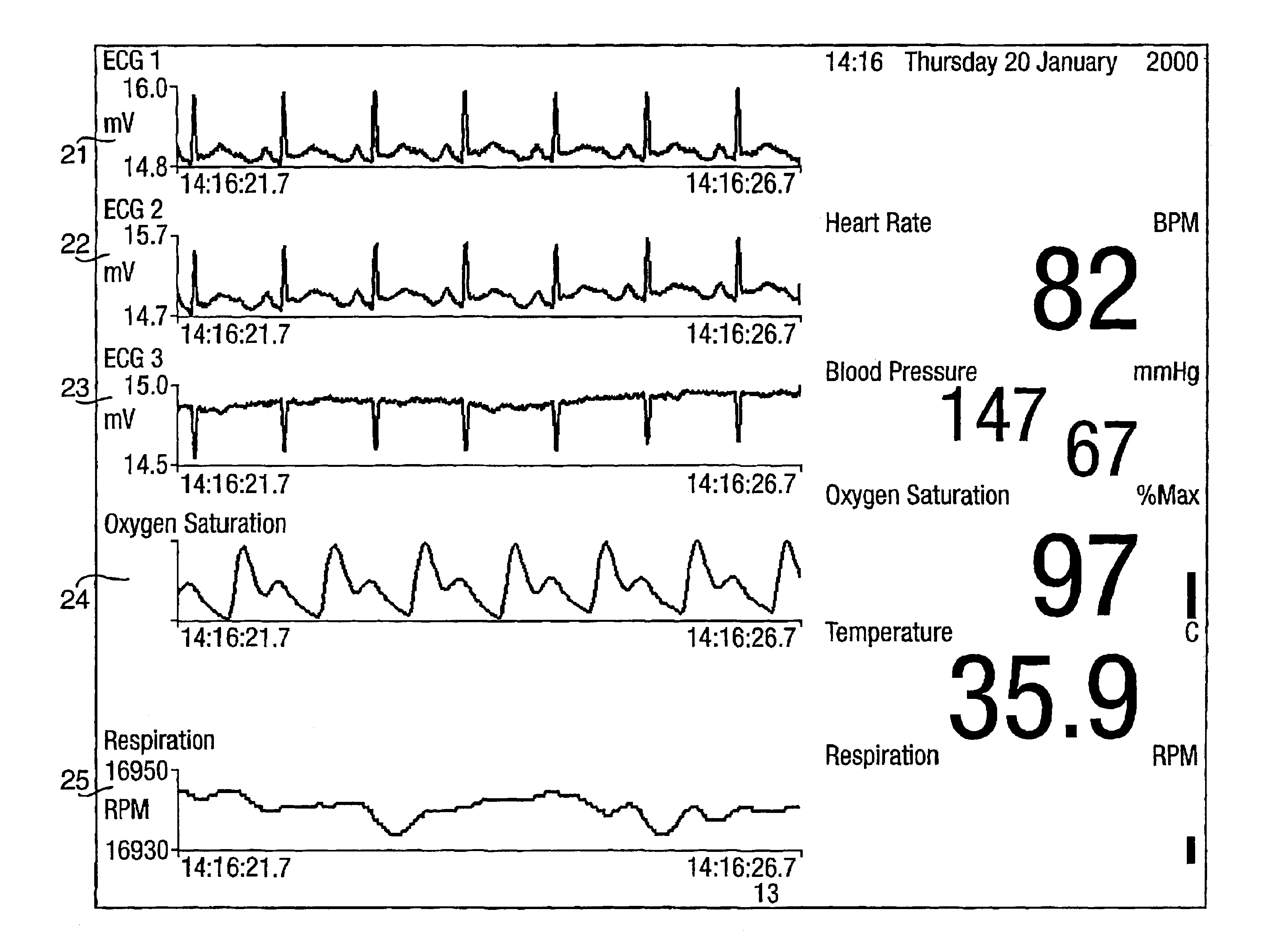 System and method for acquiring data