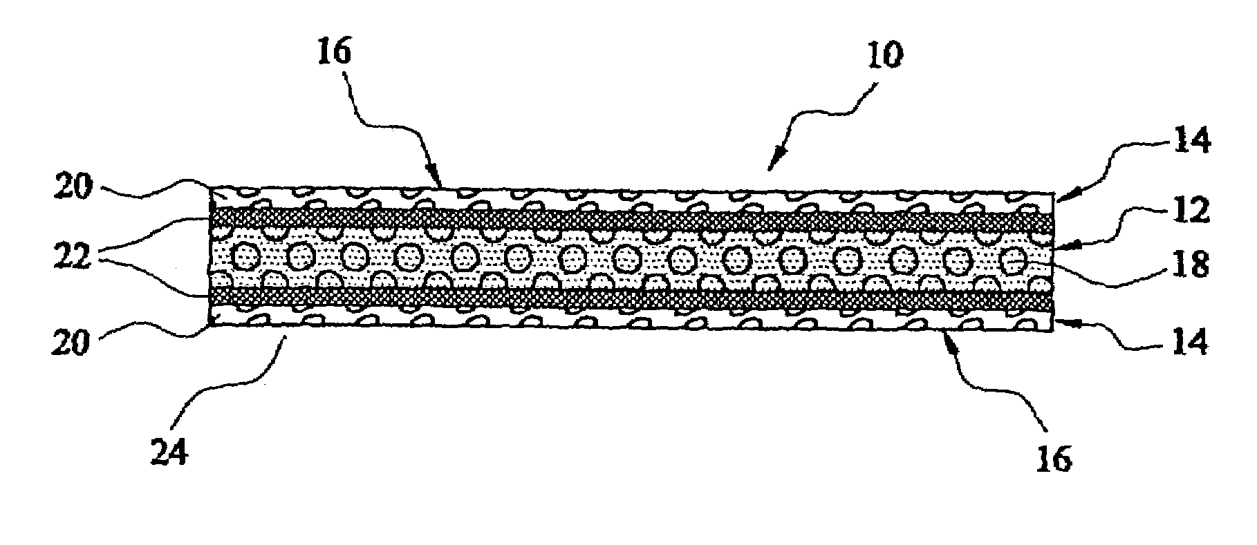 Sheet moulding compound (SMC) with ventilating structure for entrapped gases