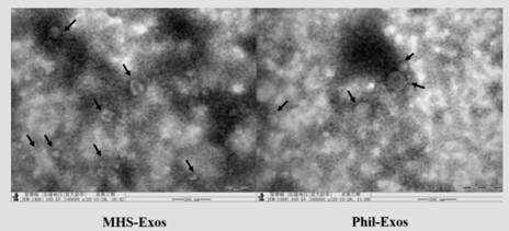 Mhs cell-derived exosome-loaded forsythin drug delivery system and its application