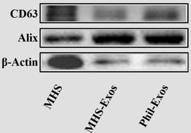 Mhs cell-derived exosome-loaded forsythin drug delivery system and its application