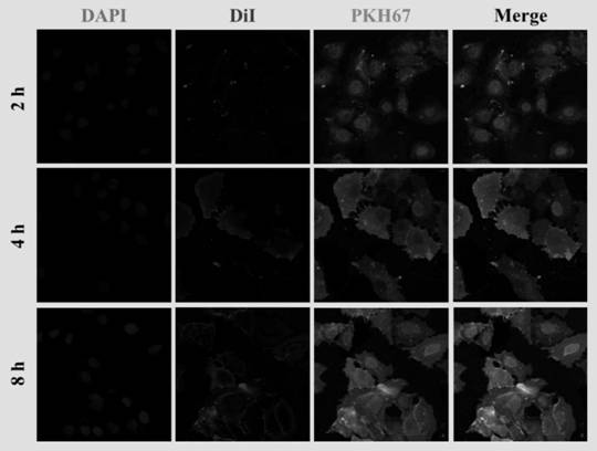 Mhs cell-derived exosome-loaded forsythin drug delivery system and its application