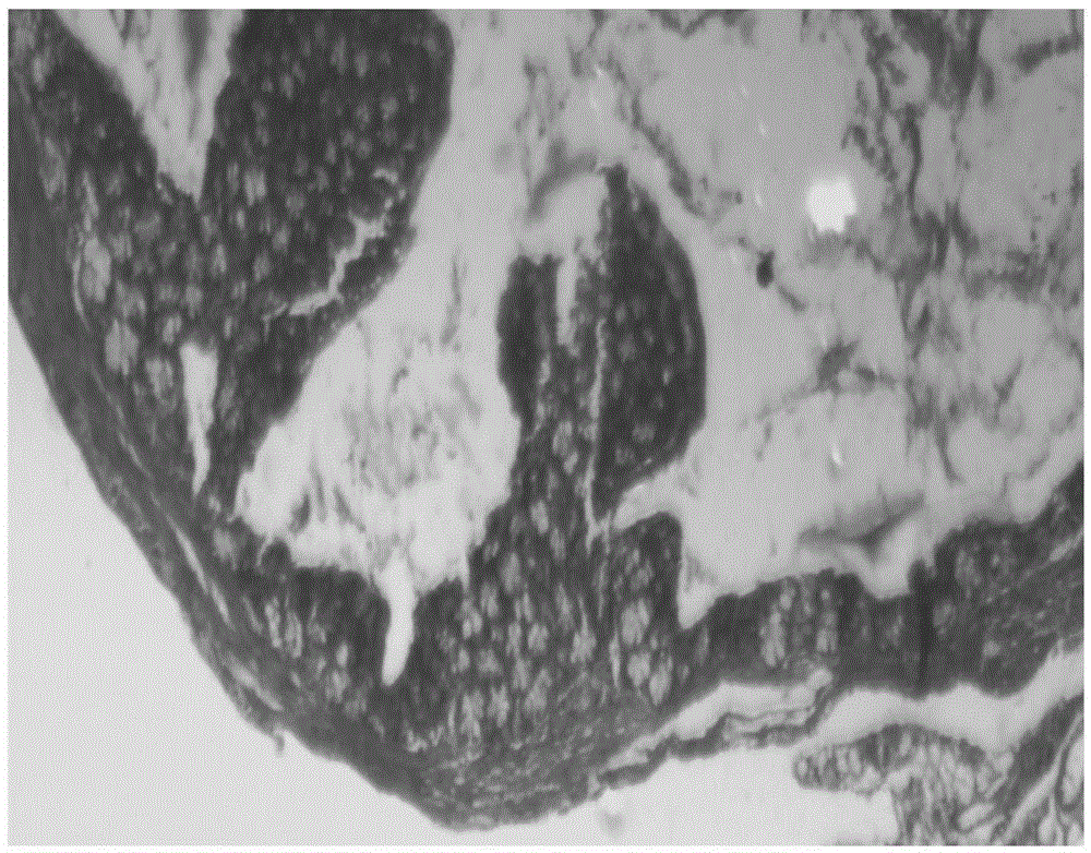 Compound probiotics and drug for treating ulcerative colitis and preparation method thereof