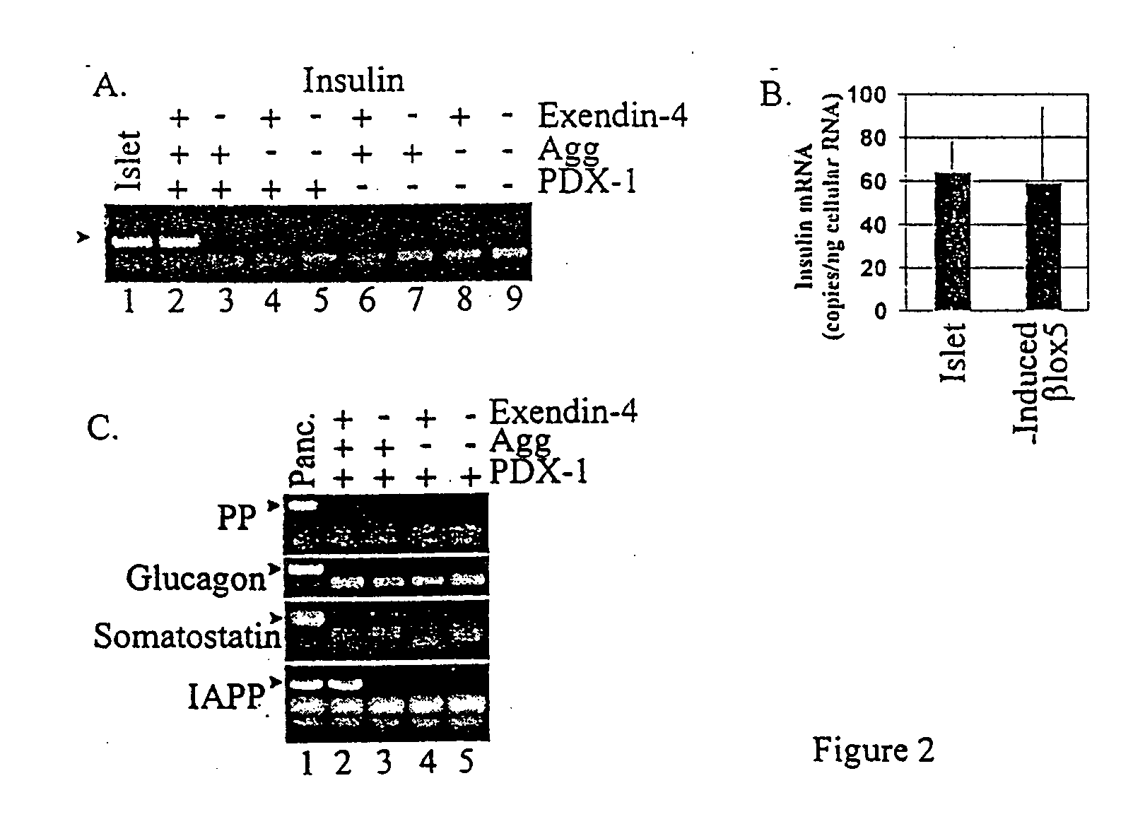 Induction of beta cell differentiation in human cells by stimulation of the GLP-1 receptor