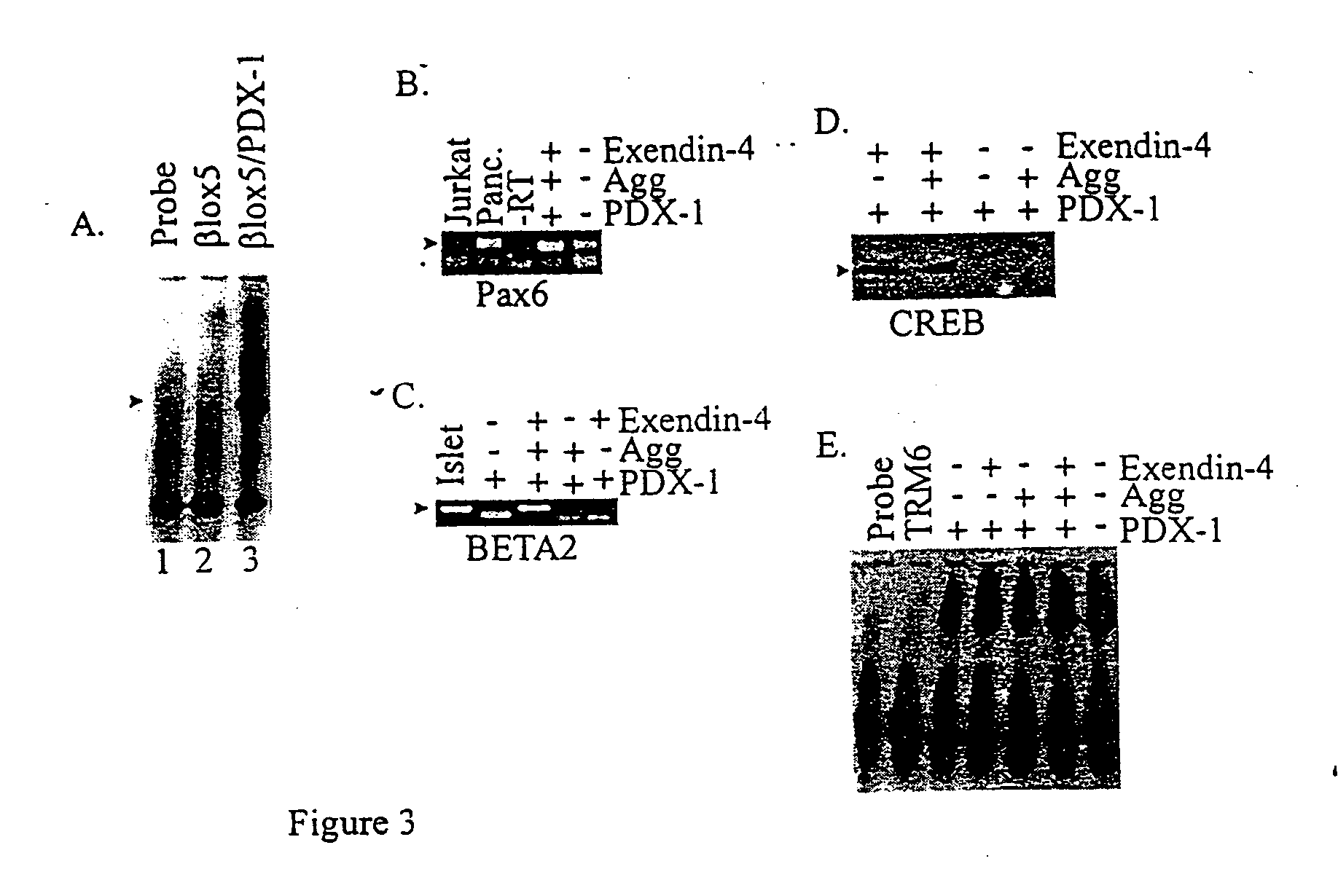 Induction of beta cell differentiation in human cells by stimulation of the GLP-1 receptor