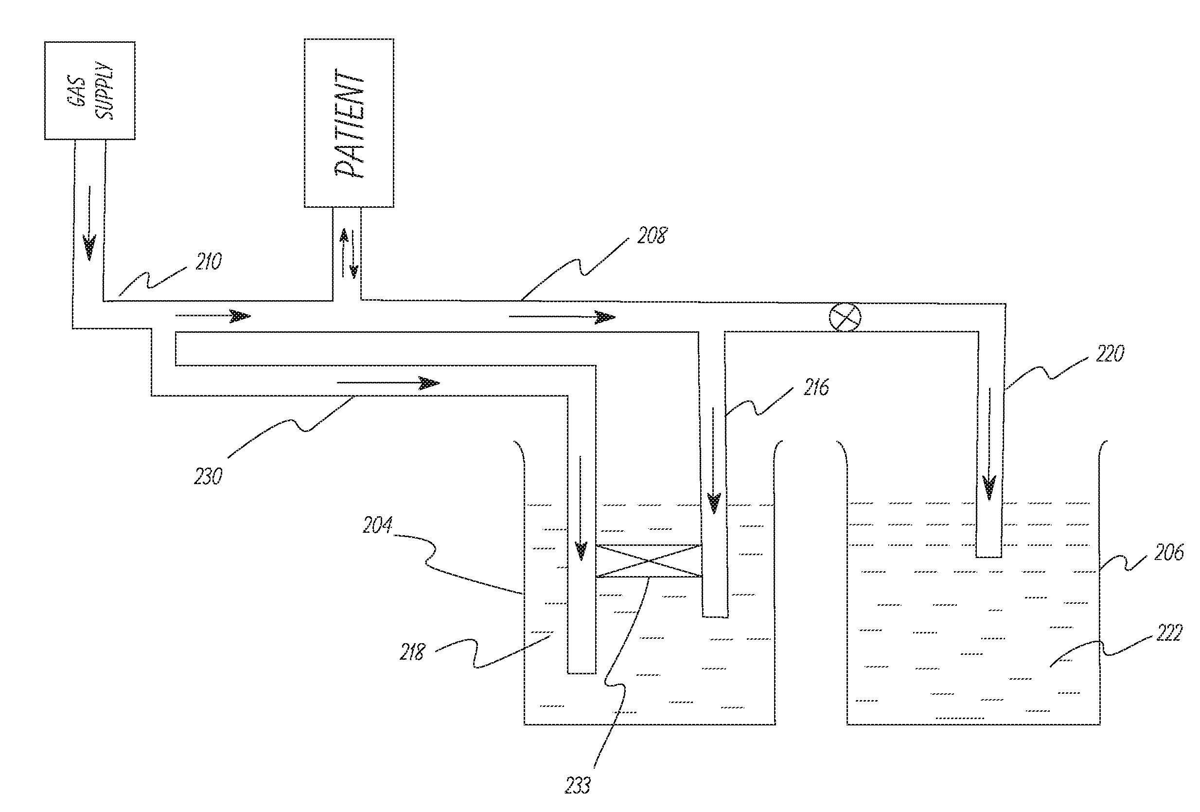 Apparatus and method to provide breathing support