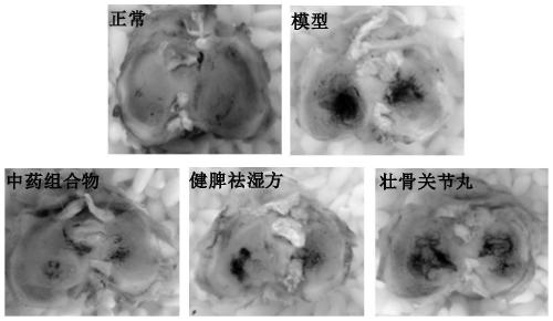 Traditional Chinese medicine composition for treating knee osteoarthritis