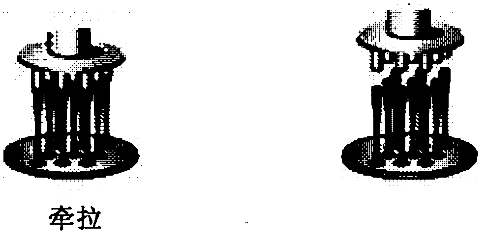 Triamcinolone biodegradable maltose microneedle array and preparation method thereof