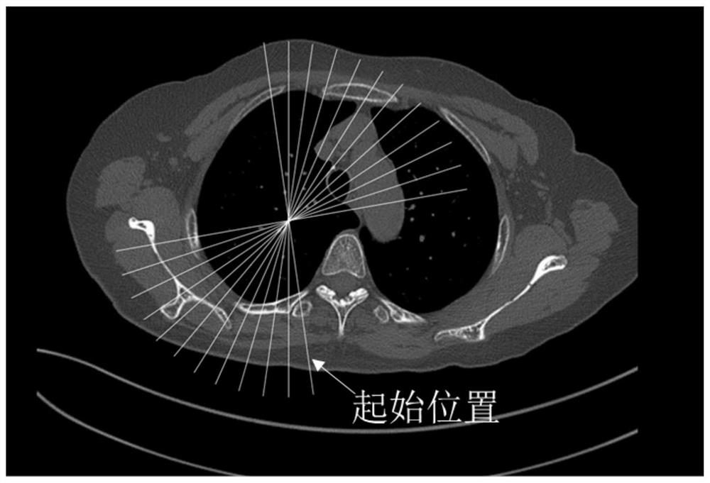 Medical image processing method, medical image processing device and medical image display method