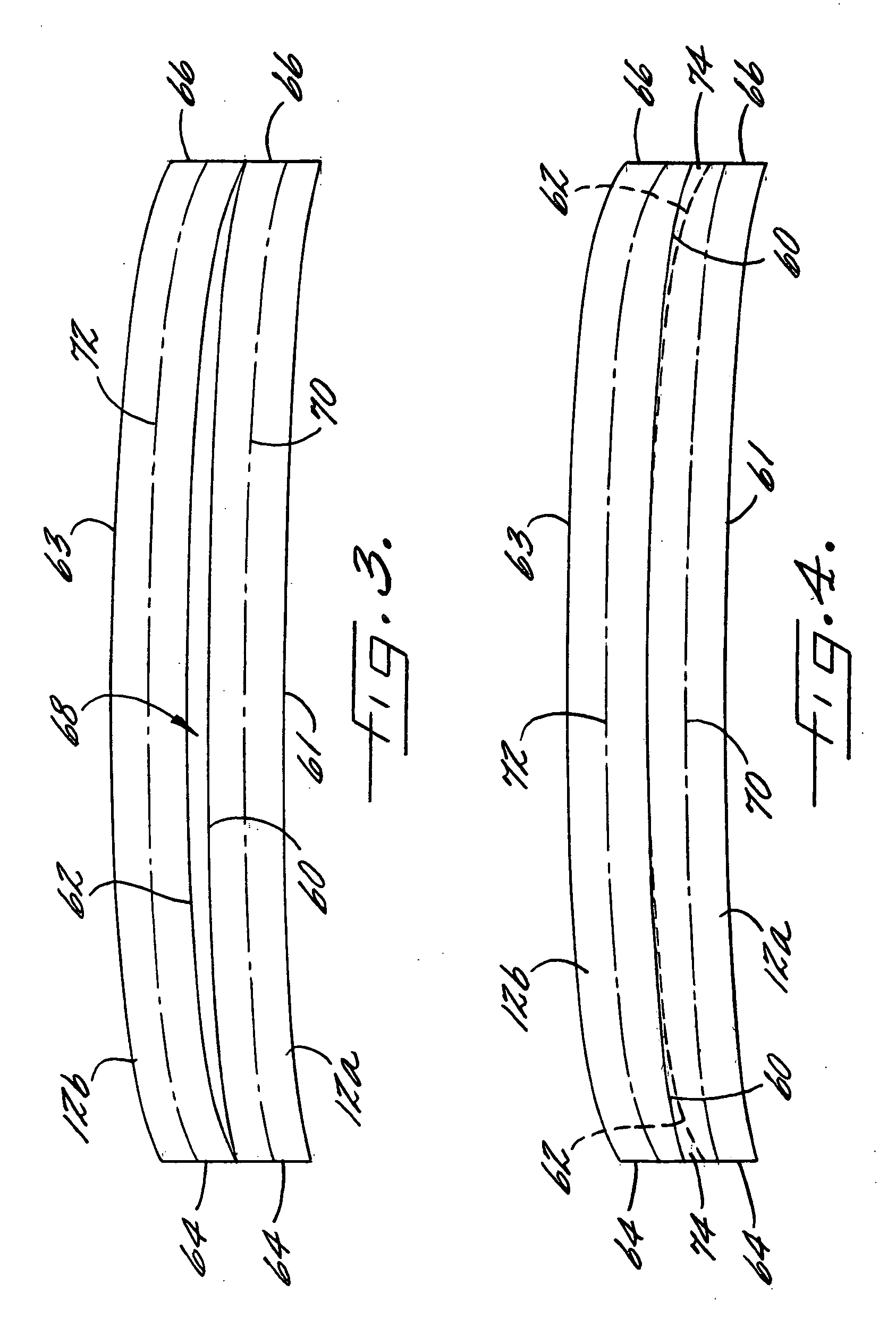 Apparatus and method for composite tape profile cutting